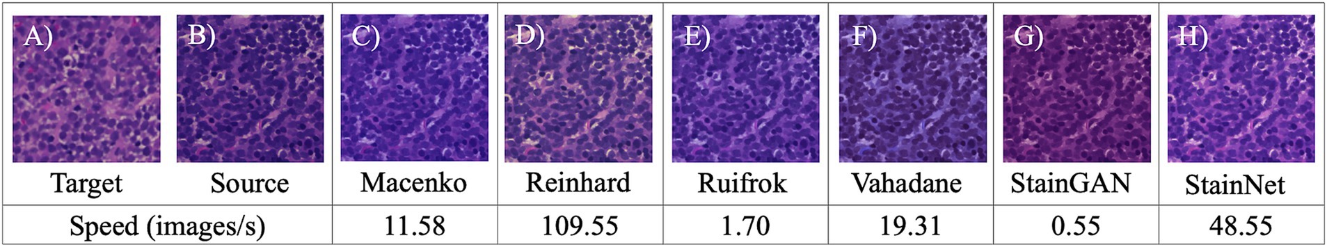 Image showing eight panels labeled A to H, with microscopic images of stained tissue sections. Each panel uses a different staining method: Macenko, Reinhard, Ruifrok, Vahadane, StainGAN, and StainNet, displayed alongside the processing speed in images per second: 11.58, 109.55, 1.70, 19.31, 0.55, and 48.55 respectively. The target and source images are labeled as A and B.