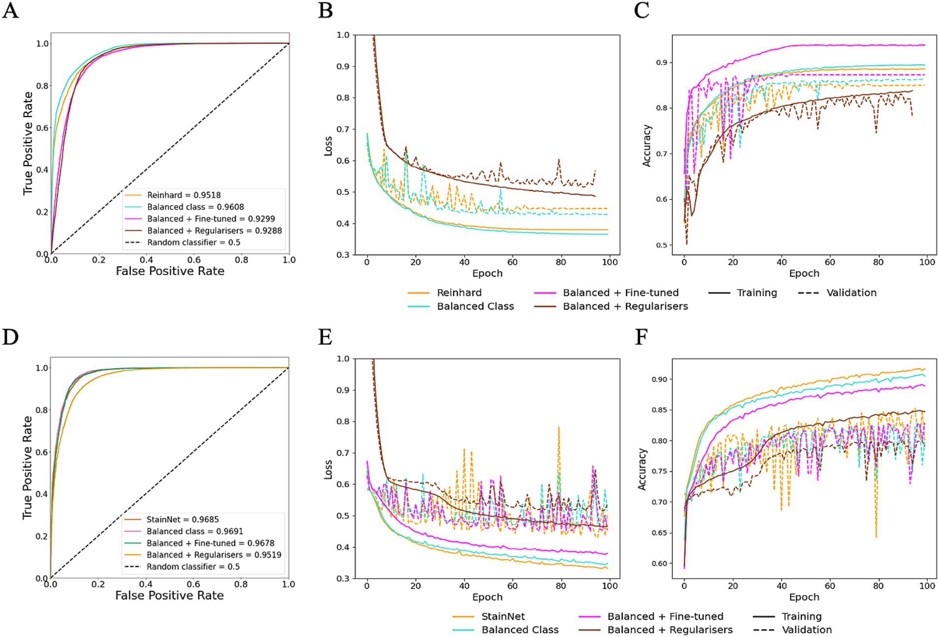 Graphs A, B, and C compare optimisations for Reinhard normalisation, while Graphs D, E, and F present corresponding comparisons for optimisations using StainNet stain normalisation. Graphs A and D show AUROC curves, B and E display loss over epochs, and C and F illustrate accuracy over epochs. Different model versions are represented by distinct coloured lines.