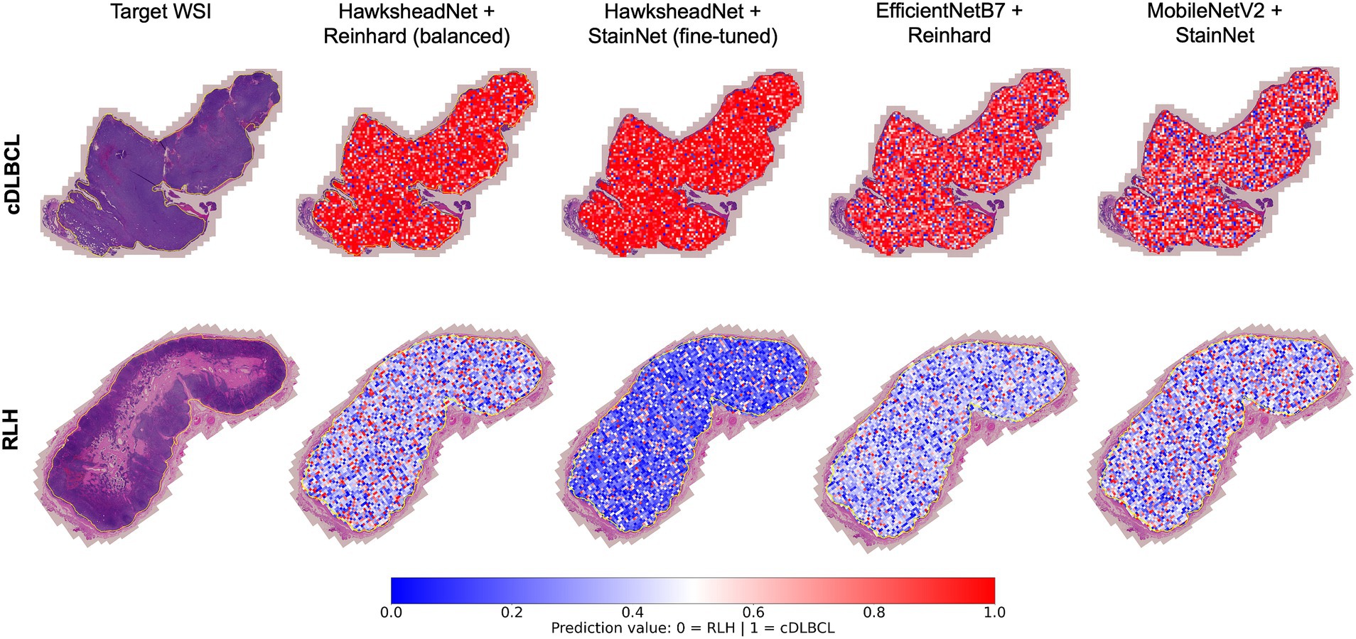 Tile-level predictions are overlaid on regions of interest within whole slide images (WSIs) to achieve WSI-level segmentation, using the best-performing HawksheadNet model and top transfer learning networks. The top row displays a confirmed case of cDLBCL, while the bottom row shows a confirmed case of RLH. Blue areas, with prediction values closer to 0, indicate non-cancerous or RLH segments, whereas red areas, with values closer to 1, suggest likely cDLBCL regions.