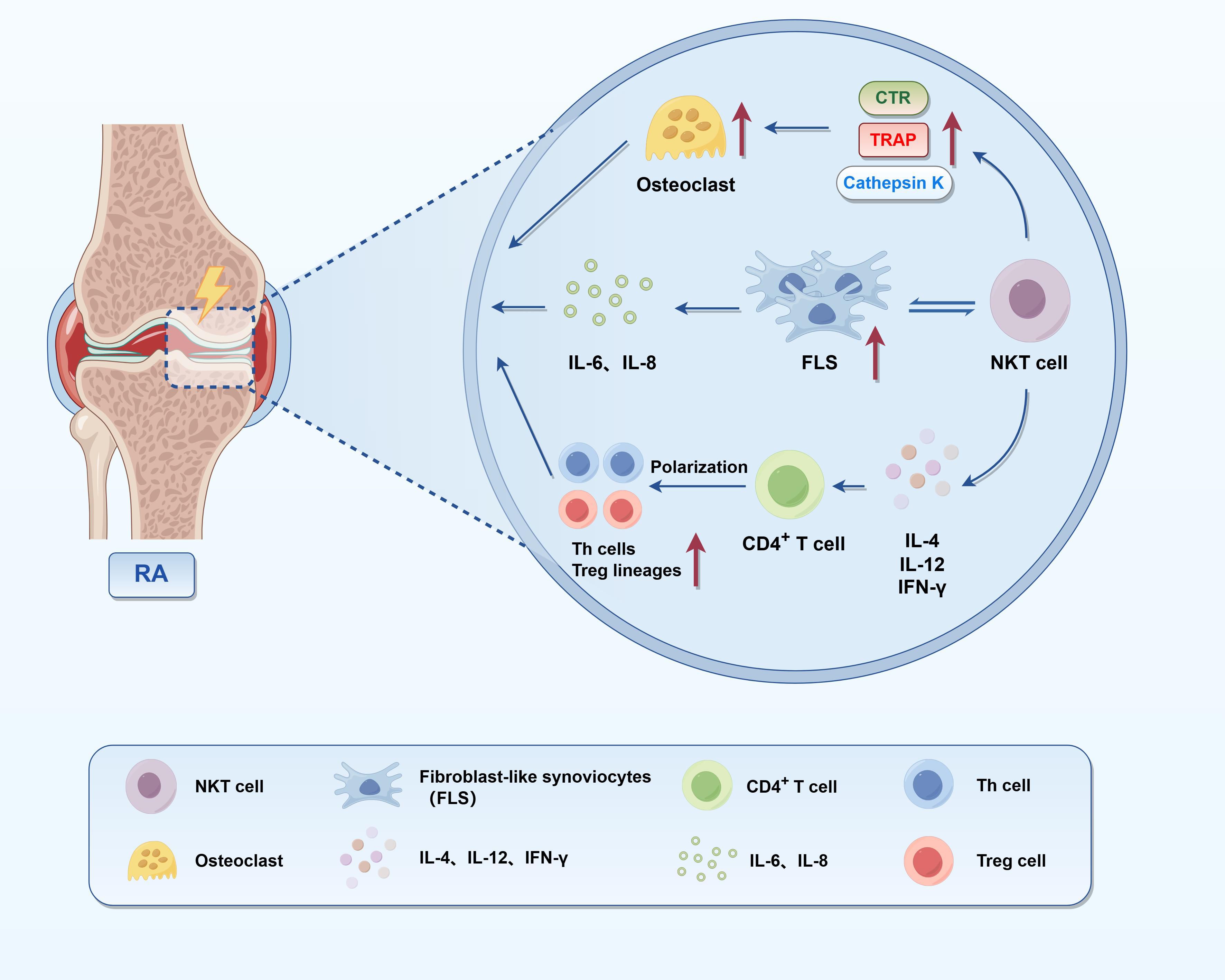 Diagram illustrating rheumatoid arthritis (RA) in a knee joint, with a zoomed-in view of cell interactions. It shows osteoclasts, fibroblast-like synoviocytes (FLS), natural killer T (NKT) cells, and CD4+ T cells. Arrows indicate interactions and cytokines: IL-6, IL-8, IL-4, IL-12, and IFN-γ. CTR, TRAP, and Cathepsin K are associated with osteoclasts. Polarization of Th cells and Treg lineages is noted. A legend clarifies the cell types and cytokines.