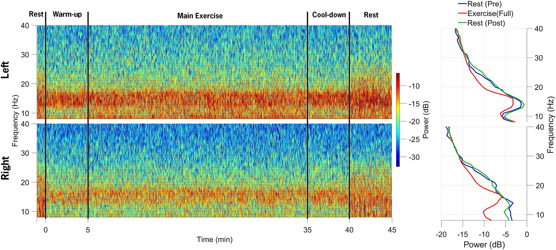 Spectograms and line graphs of local field potential (LFP) data from the subthalamic nucleus (STN). Data from the left STN and right STN are displayed during rest, warm-up, main exercise, cool-down, and rest. Color gradient indicates power levels, with red representing higher power. The accompanying line graphs compare frequency and power changes in pre-exercise, exercise, and post-exercise states.