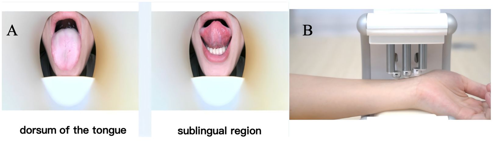 Panel A shows two images: the dorsum of the tongue and the sublingual region, featuring different tongue positions. Panel B displays a forearm placed under a medical device.