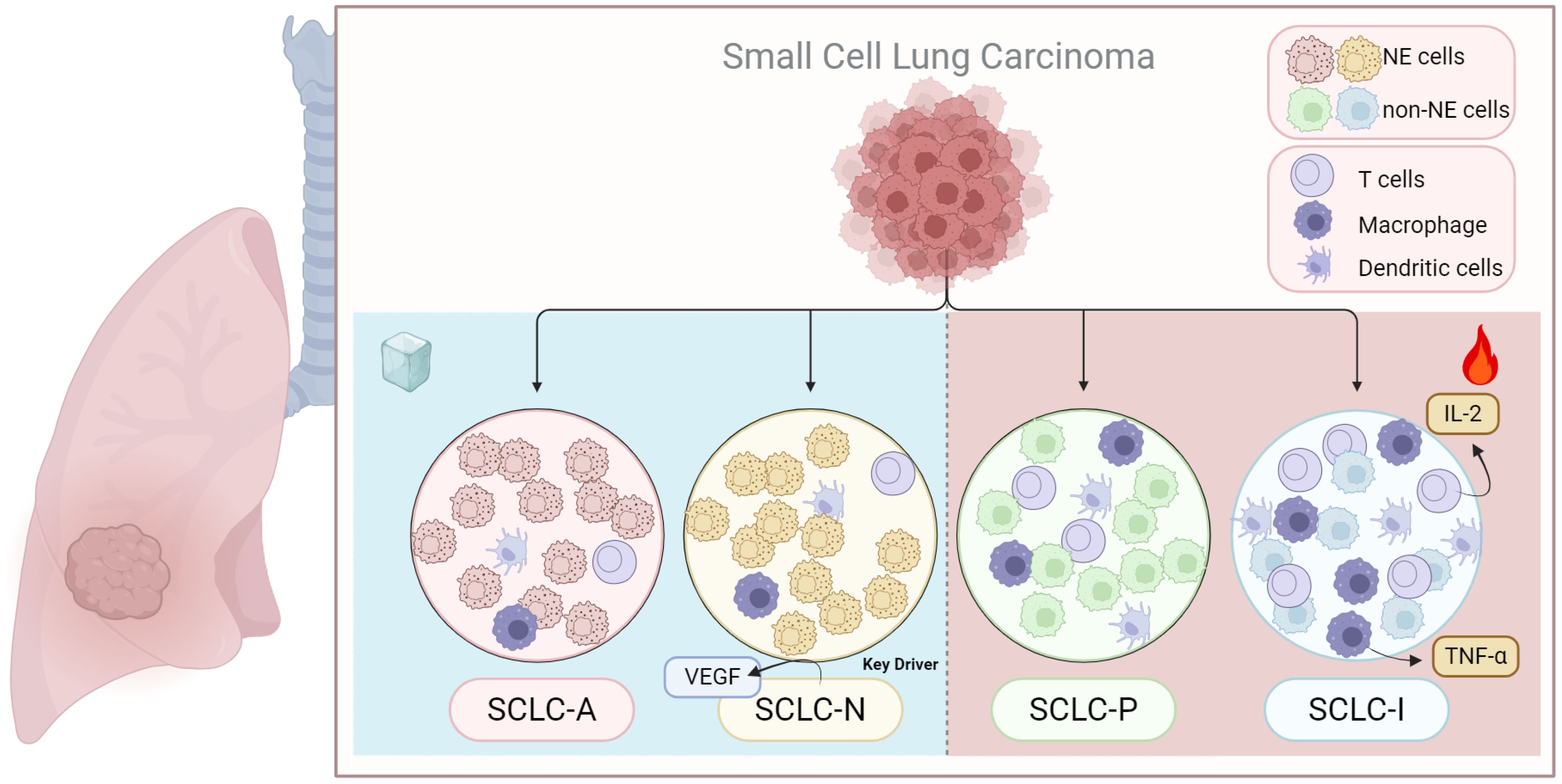 Illustration detailing small cell lung carcinoma (SCLC) subtypes: SCLC-A, SCLC-N, SCLC-P, and SCLC-I. Each subtype shows different cell compositions, with labeled key drivers like VEGF, IL-2, and TNF-α. The diagram includes symbols indicating NE cells, non-NE cells, T cells, macrophages, and dendritic cells, alongside a lung diagram with a highlighted tumor.