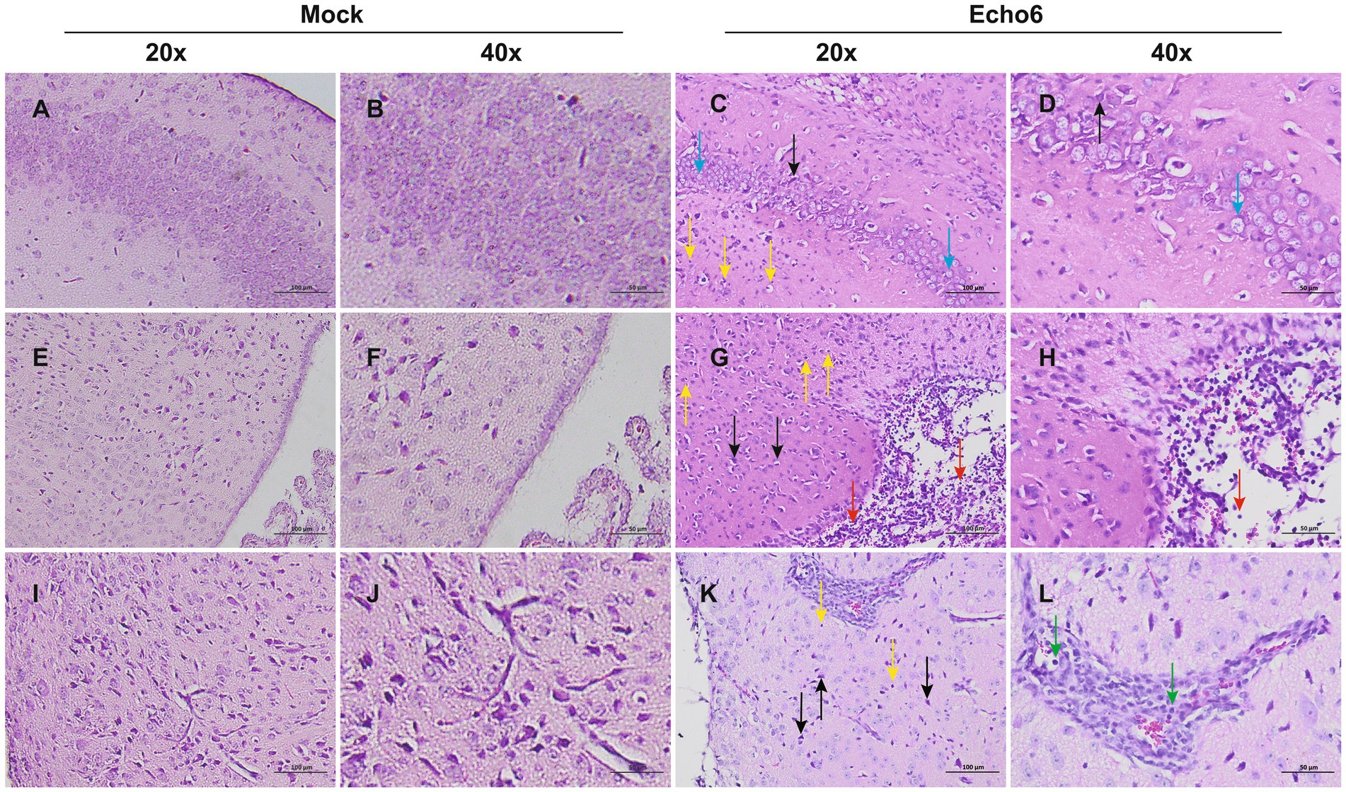 Microscopic images showing tissue samples at different magnifications (20x and 40x) under