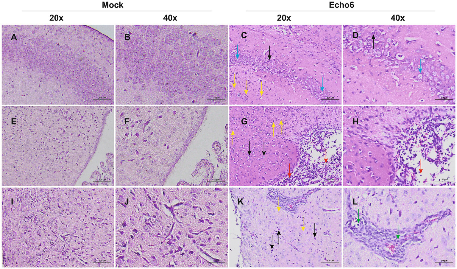 Microscopic images showing tissue samples at different magnifications (20x and 40x) under "Mock" and "Echo6" conditions. Panels A, B, E, F, I, and J depict Mock samples with consistent cellular distribution. Panels C, D, G, H, K, and L show Echo6 samples. Arrows in C, D, G, H, K, and L highlight specific cellular features or abnormalities. Arrows are colored yellow, red, blue, green, and black, indicating different focal points or cell types.