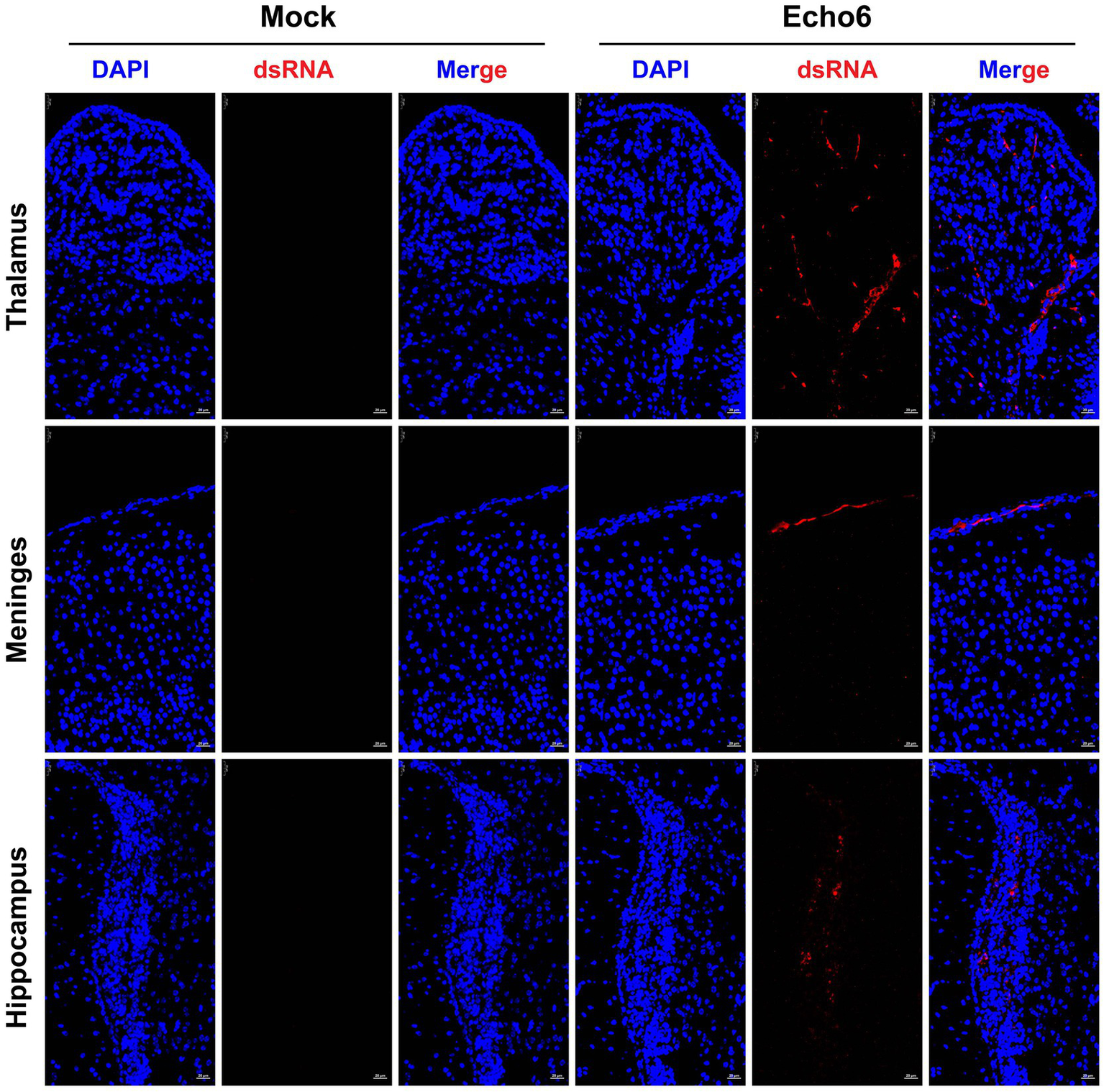 Fluorescent microscopy images comparing Mock and Echo6-treated samples of thalamus, meninges, and hippocampus tissue. DAPI staining shows blue nuclei. dsRNA appears in red for Echo6, indicating viral presence. Merged images combine both stains.