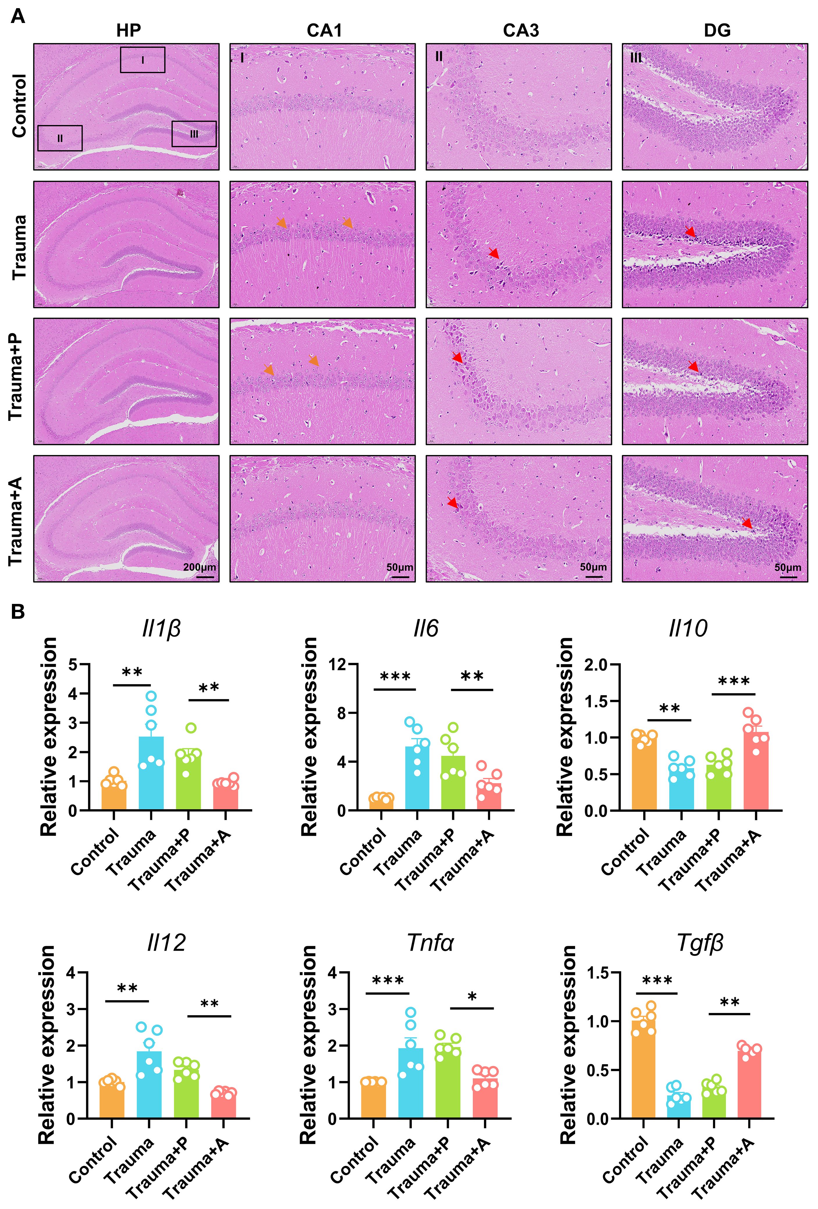 Panel A shows hippocampal histology in control, trauma, Trauma+P, and Trauma+A groups, with regions HP, CA1, CA3, and DG highlighted. Panel B presents bar graphs of relative expression levels of inflammatory markers Il1β, Il6, Il10, Il12, Tnfa, and Tgfβ across the same groups, with significance denoted by asterisks.