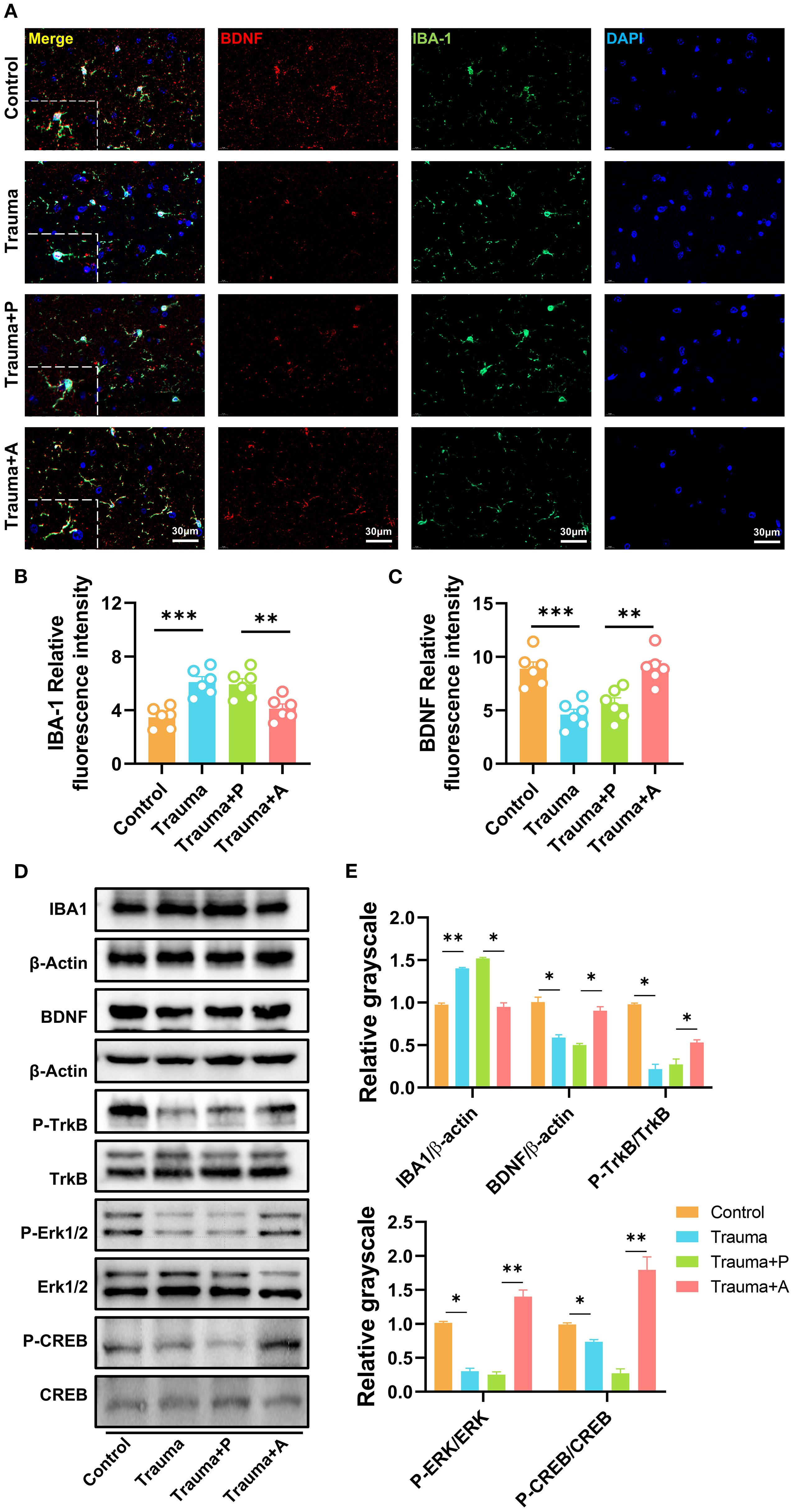 A multi-panel image depicts experimental data on brain tissue. Panel A shows fluorescent microscopy images of brain sections stained for BDNF (red), IBA-1 (green), and DAPI (blue) under four conditions: Control, Trauma, Trauma+P, and Trauma+A. Panels B and C are bar graphs showing relative fluorescence intensity for IBA-1 and BDNF across the same conditions, indicating significant differences. Panel D displays Western blot images for IBA1, BDNF, and other proteins. Panel E presents bar graphs with relative grayscale values for protein expression analysis. Significance is indicated with asterisks.