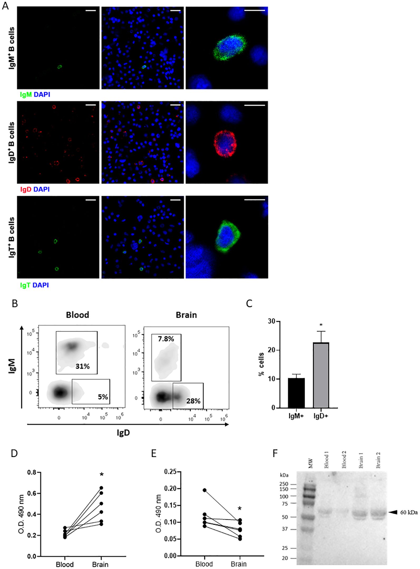 Panel A displays fluorescent microscopy images of B cells stained with IgM, IgD, and IgT markers alongside DAPI. Panel B shows flow cytometry dot plots of IgM and IgD expression in blood and brain, leukocytes highlighting population percentages. Panel C features a bar graph comparing IgM+ and IgD+ cell percentages, within brain population. Panels D and E are line graphs showing optical density measurements for secreted IgD (D) and IgM (E) in blood and brain 48h supernatant cultures evaluated by ELISA. Panel F depicts a Western blot of secreted IgT in blood and brain 48h supernatant cultures, highlighting a band at 60 kilodaltons.