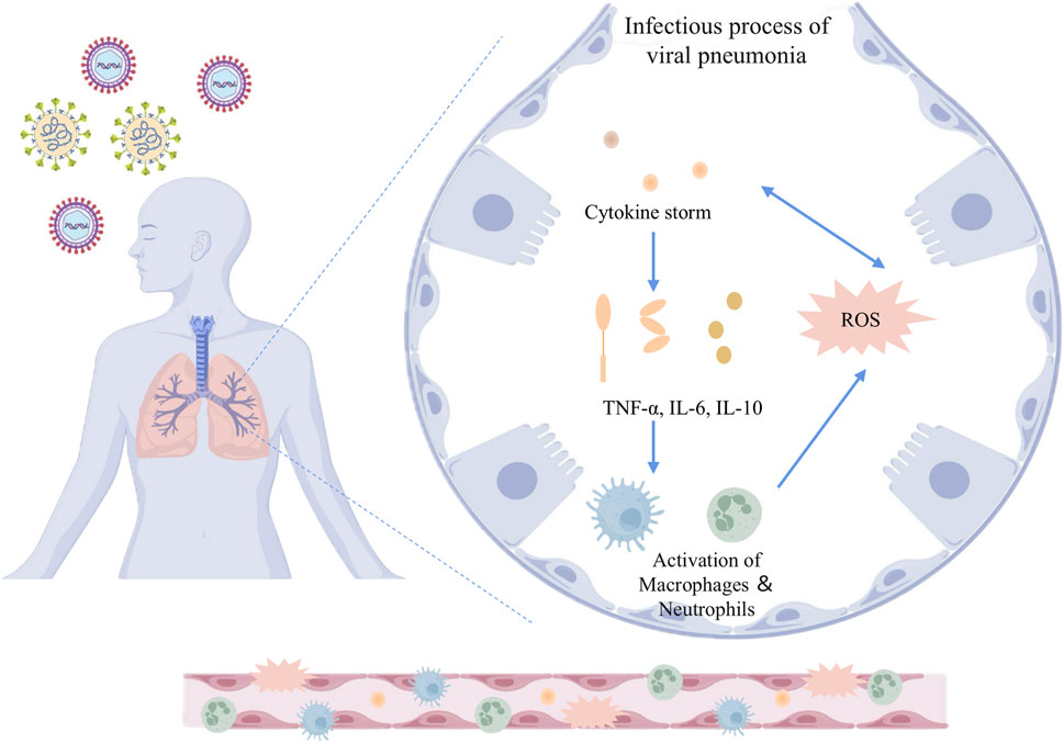 Diagram illustrating the infectious process of viral pneumonia. It shows virus particles interacting with a person's respiratory system. A close-up details the cascade: cytokine storm leads to TNF-alpha, IL-6, IL-10 production, reactive oxygen species (ROS) generation, and macrophage and neutrophil activation.