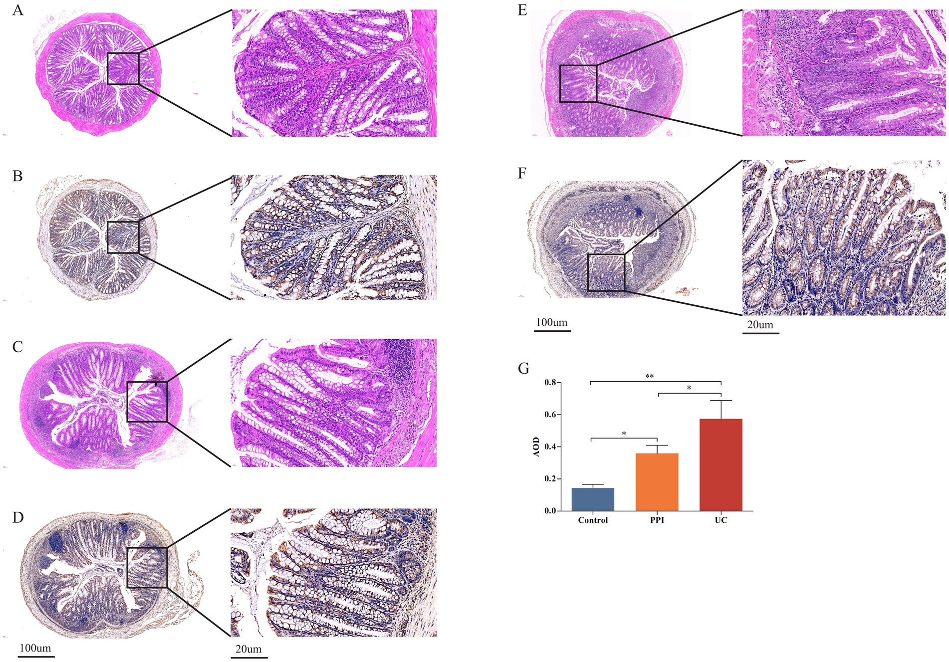 Histological images A to F show cross-sections of tissue stained with different techniques. Each pair (A-F) includes a low magnification image and a zoomed-in section showing detailed cellular structure. Image G is a bar graph comparing average optical density (AOD) among three groups: Control, PPI, and UC. Control shows the lowest AOD, PPI shows moderate, and UC shows the highest. Statistical significance is indicated with asterisks. Scale bars are provided in images D, F, and G for size reference.