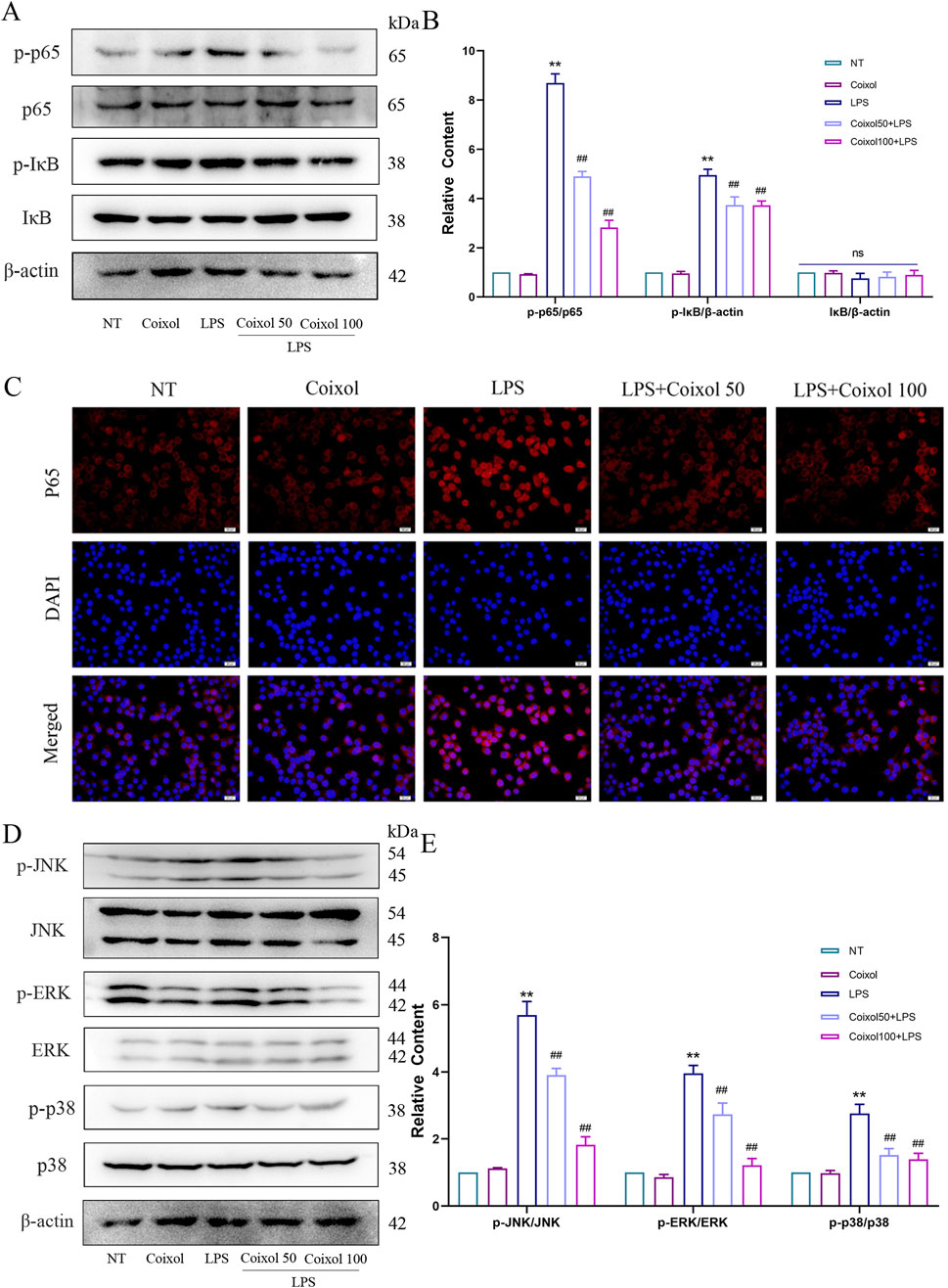 Western blot and immunofluorescence analysis results. Panel A shows Western blots for proteins p-p65, p65, p-IκB, IκB, and β-actin, analyzed under different treatments (NT, Coixol, LPS, Coixol 50 LPS, Coixol 100 LPS). Panel B provides a graph of relative protein content with bars for each treatment condition. Panel C displays fluorescence images showing P65 and DAPI staining along with their merged results under similar conditions. Panel D presents Western blots for p-JNK, JNK, p-ERK, ERK, p-p38, and p38. Panel E offers a corresponding bar graph of relative content for these proteins. Data indicate statistical significance with asterisks.
