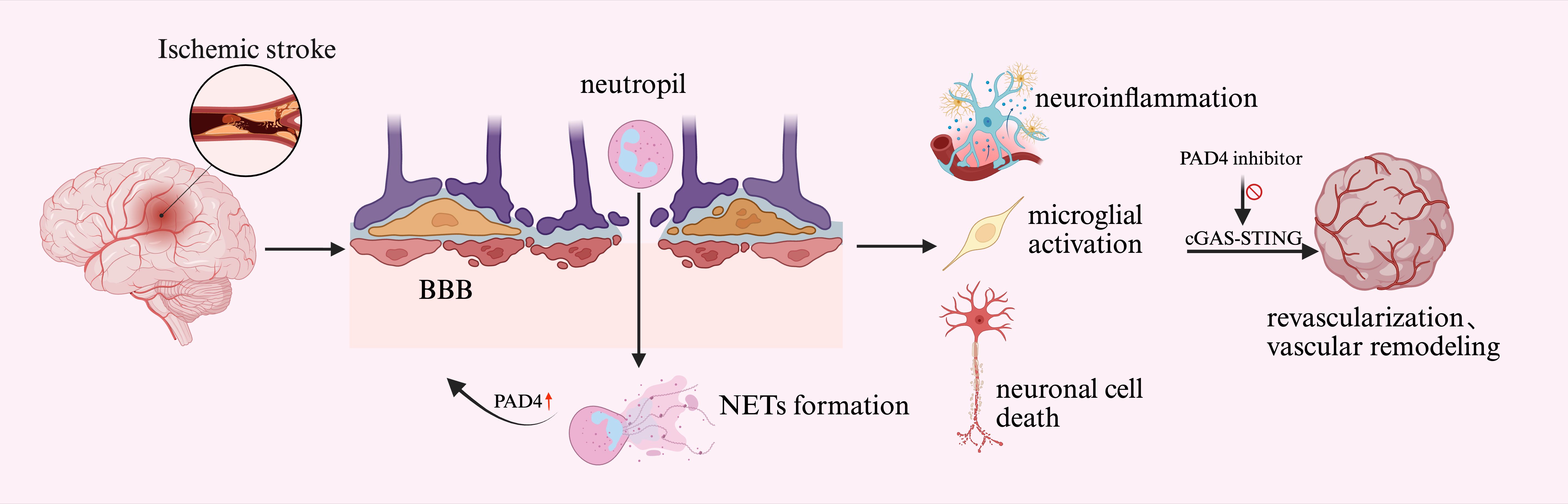 Diagram illustrating the pathway of ischemic stroke. It shows a brain with blocked blood flow leading to a breakdown of the blood-brain barrier (BBB), neutrophil infiltration, and NETs formation. This causes microglial activation and neuroinflammation, resulting in neuronal cell death. The PAD4 inhibitor pathway prevents this by blocking cGAS-STING, promoting revascularization and vascular remodeling.