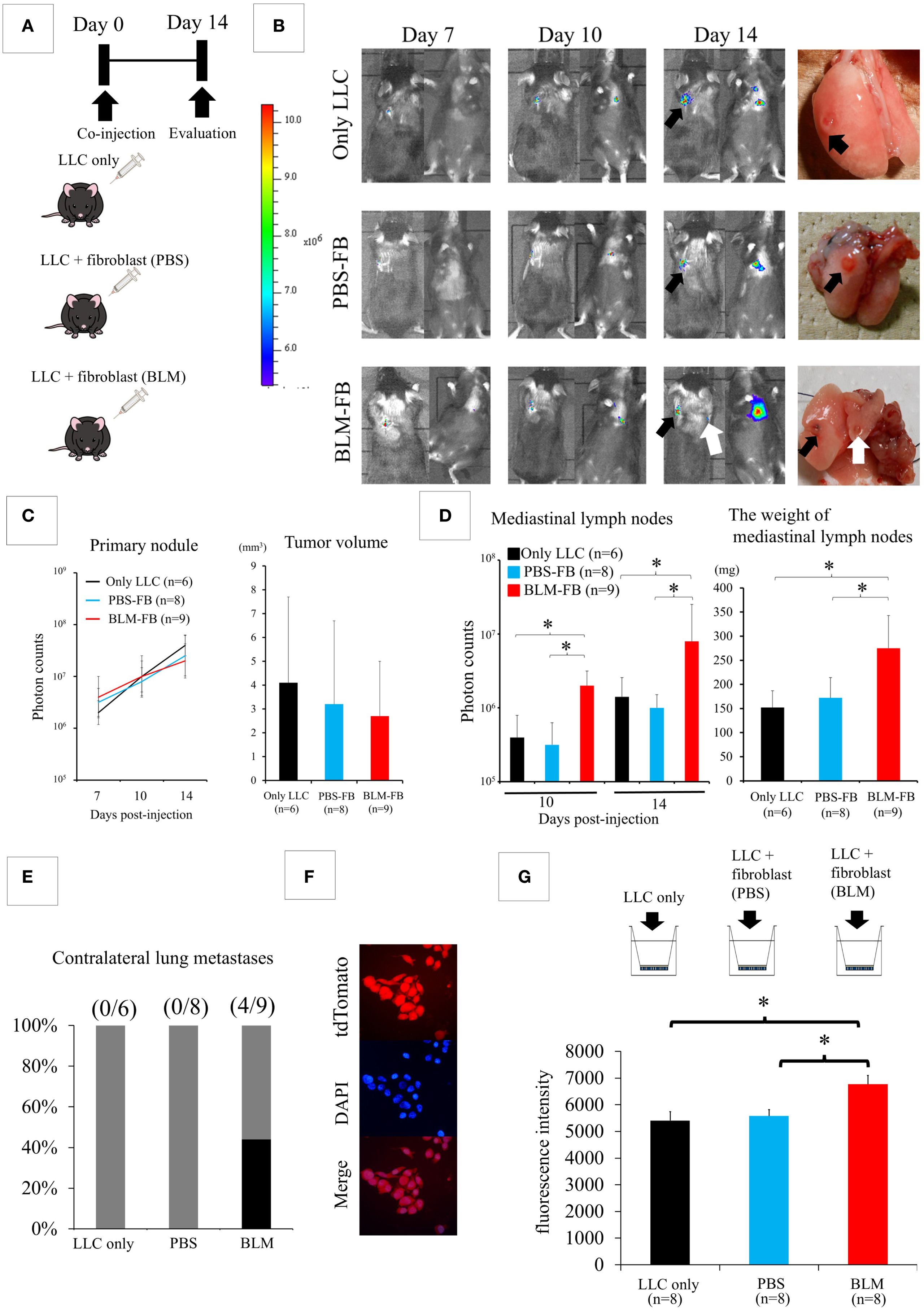 Diagram depicting experimental results of LLC tumor growth in mice. Panel A shows the experimental timeline and groups: LLC only, LLC with fibroblast (PBS), and LLC with fibroblast (BLM). Panel B displays imaging of tumor progression at days 7, 10, and 14, with corresponding gross pathology images. Panel C presents graphs of primary nodule photon counts and tumor volumes. Panel D contains bar graphs comparing medial lymph node photon counts and weights. Panel E illustrates contralateral lung metastases occurrence. Panel F shows fluorescence images with tdTomato and DAPI staining. Panel G includes a bar graph comparing fluorescence intensity among groups.