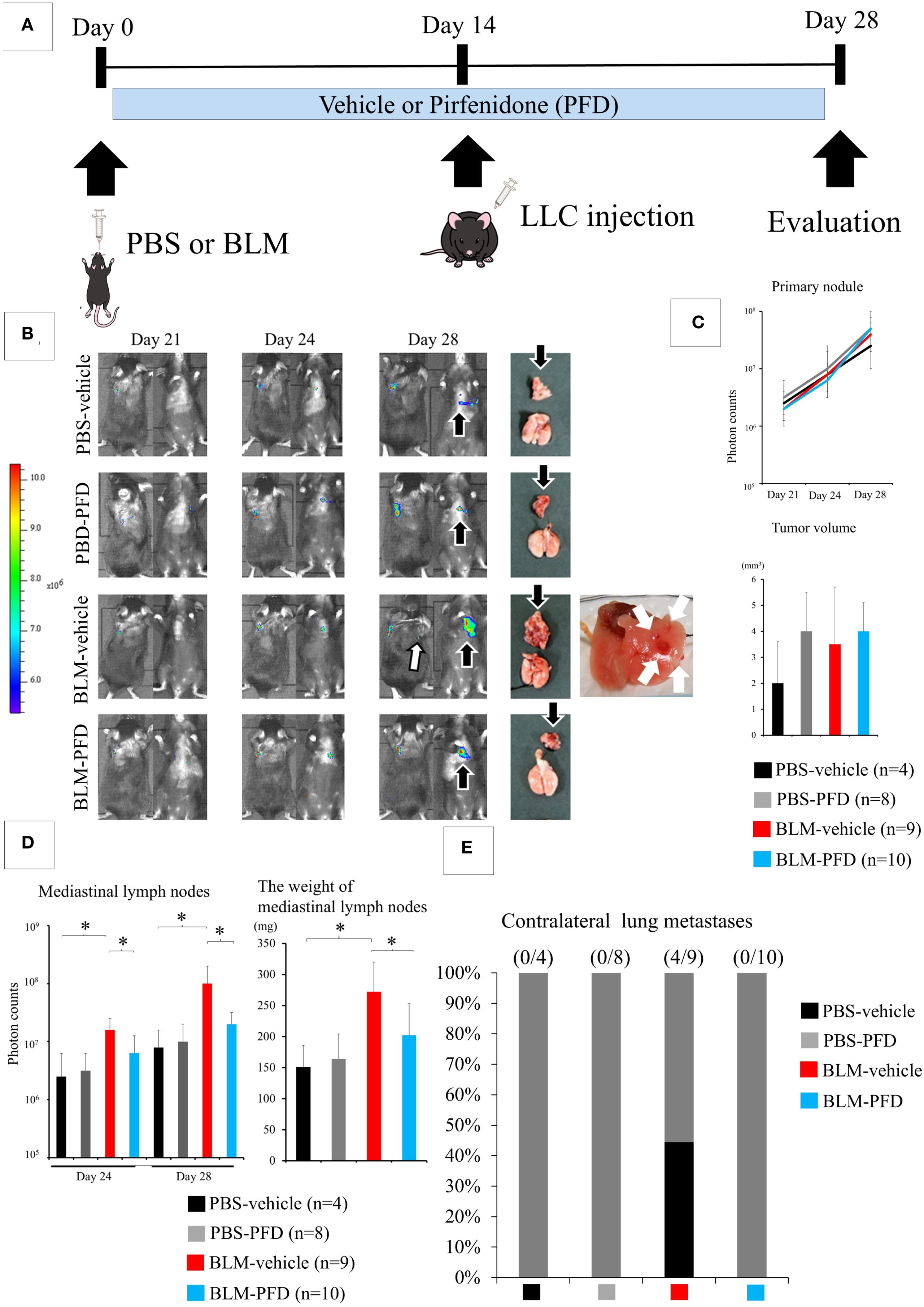 Timeline of an experiment with mice, detailing treatments and evaluations. Panel A shows a timeline from day 0 to 28, with PBS or BLM treatments followed by LLC injection and evaluation. Panel B shows MRI images of mice on days 21, 24, and 28 under four conditions: PBS-vehicle, PFD, BLM-vehicle, and BLM-PFD. Panel C presents graphs of primary nodule photon counts and tumor volume over time. Panel D shows bar graphs of mediastinal lymph node photon counts and weights. Panel E displays contralateral lung metastases percentages for different groups. Arrows and labels indicate key areas.