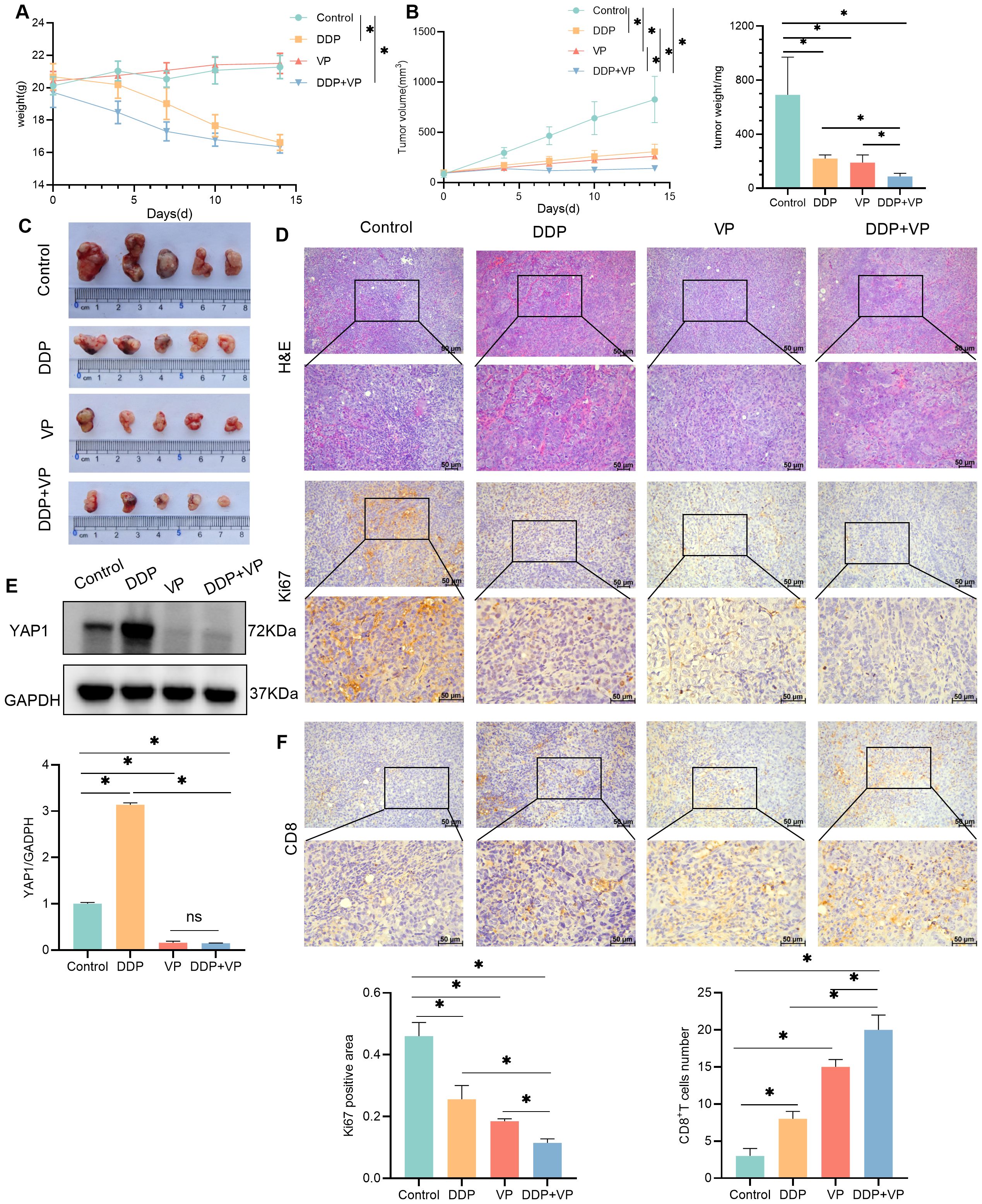 Graphs and images display the effects of Control, DDP, VP, and DDP+VP on mouse models, showing body weight, tumor volume, and tumor weight over time. Tumor samples (C) and histological analyses (D, F) reveal differences in H&E, Ki67, and CD8 staining across treatments. Western blot (E) shows YAP1 and GAPDH levels, with a bar graph comparing YAP1 expression. All data include statistical significance indicators.