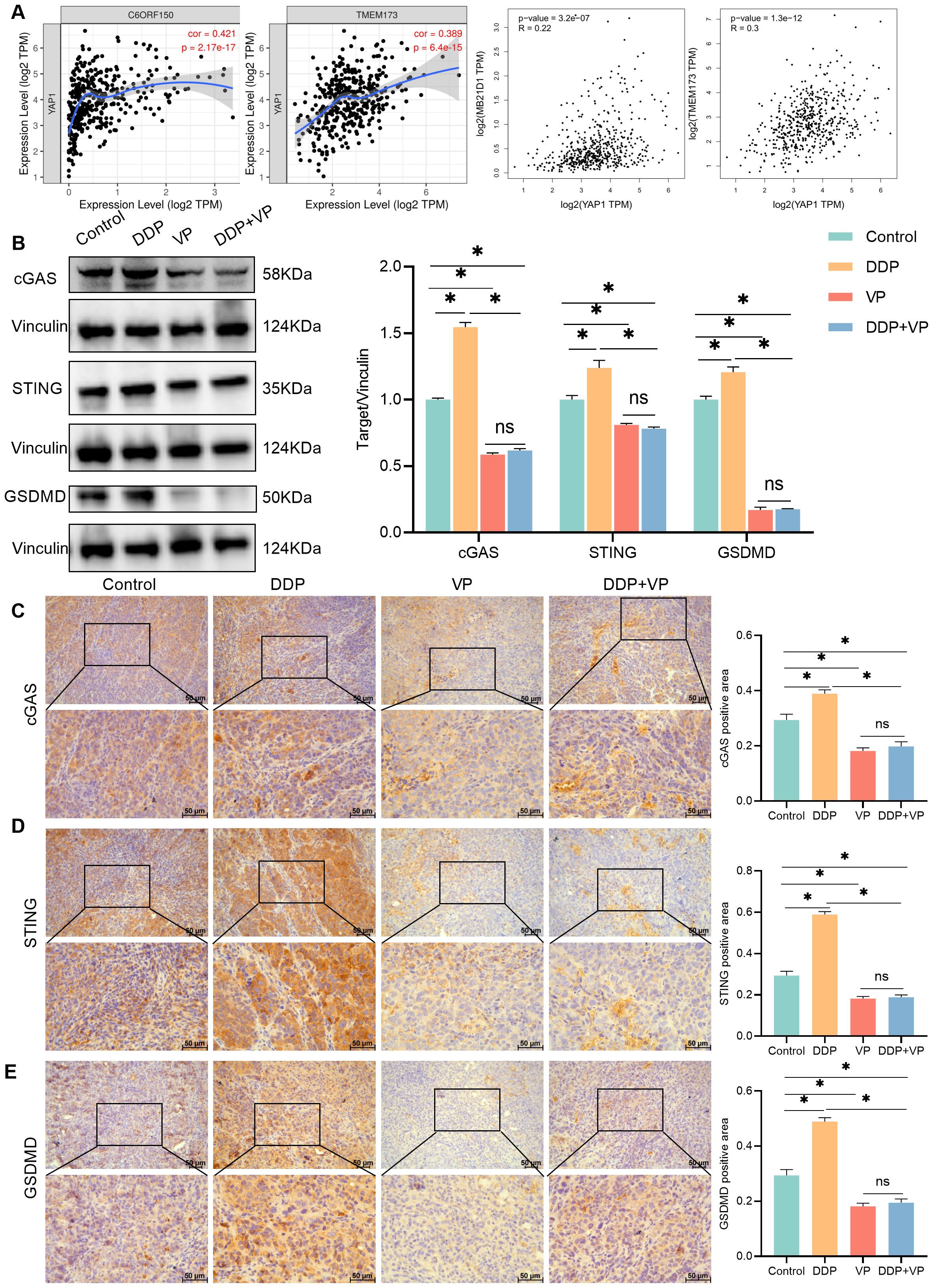 The image consists of four panels labeled A, B, C, D, and E. Panel A shows scatter plots depicting expression levels and correlation coefficients for genes CS6ORF150, TMEM173, and their relationship with YAP1 expression. Panel B contains Western blot images for cGAS, STING, and GSDMD, with Vinculin as a loading control, and a bar graph comparing their expression across different experimental conditions: Control, DDP, VP, and DDP+VP. Panels C, D, and E display immunohistochemistry images for cGAS, STING, and GSDMD, respectively, across the same conditions, with accompanying bar graphs showing quantification of positive areas. Statistical significance is indicated with asterisks.