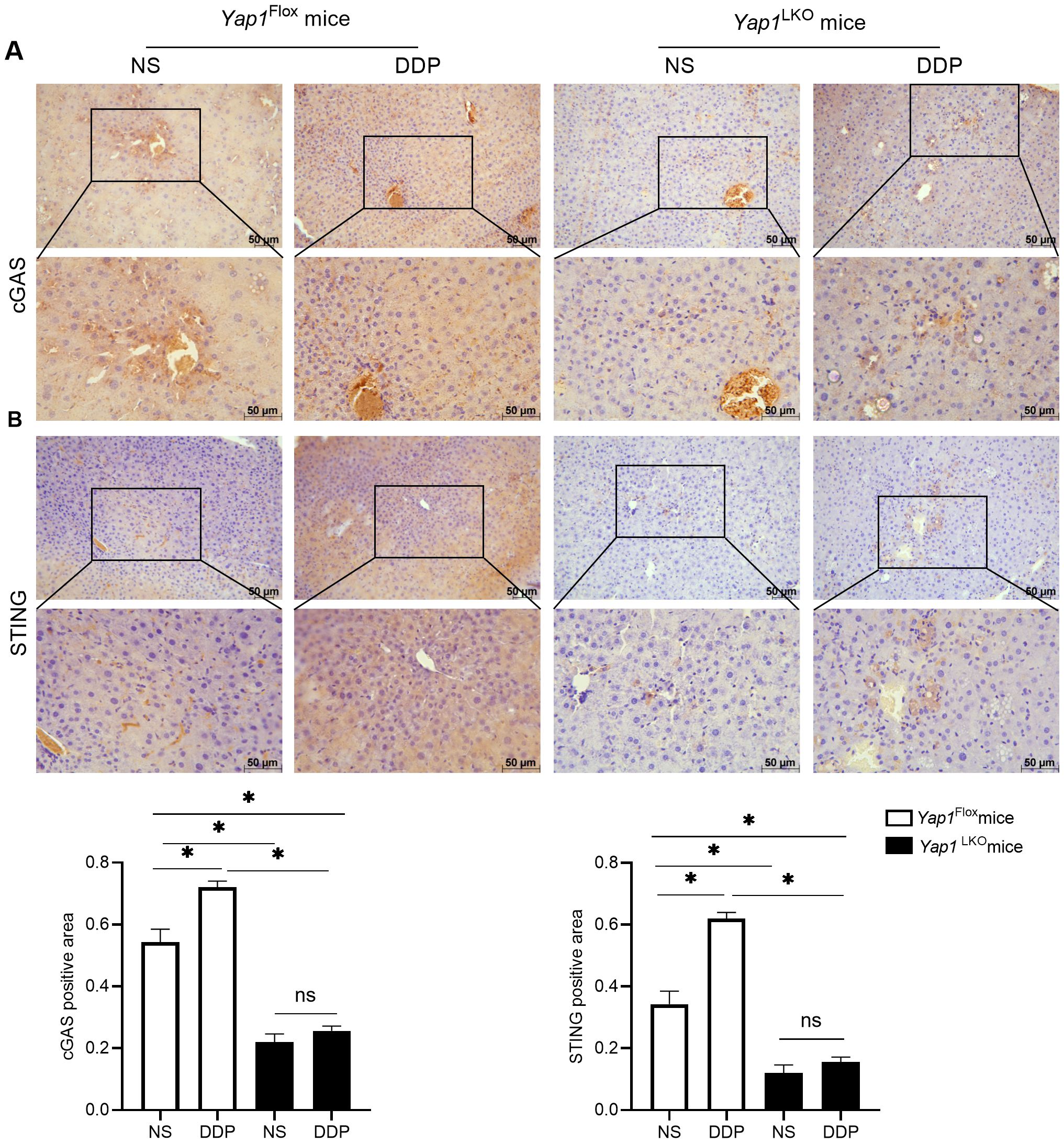 Histological sections and bar graphs show the effects of NS and DDP treatments on Yap1^Flox and Yap1^LKO mice. The top images display cGAS staining, and the bottom images show STING. Insets highlight variations in staining intensity. The graphs quantify positive staining areas, indicating significant differences in response to treatments. Scale bars measure fifty micrometers.