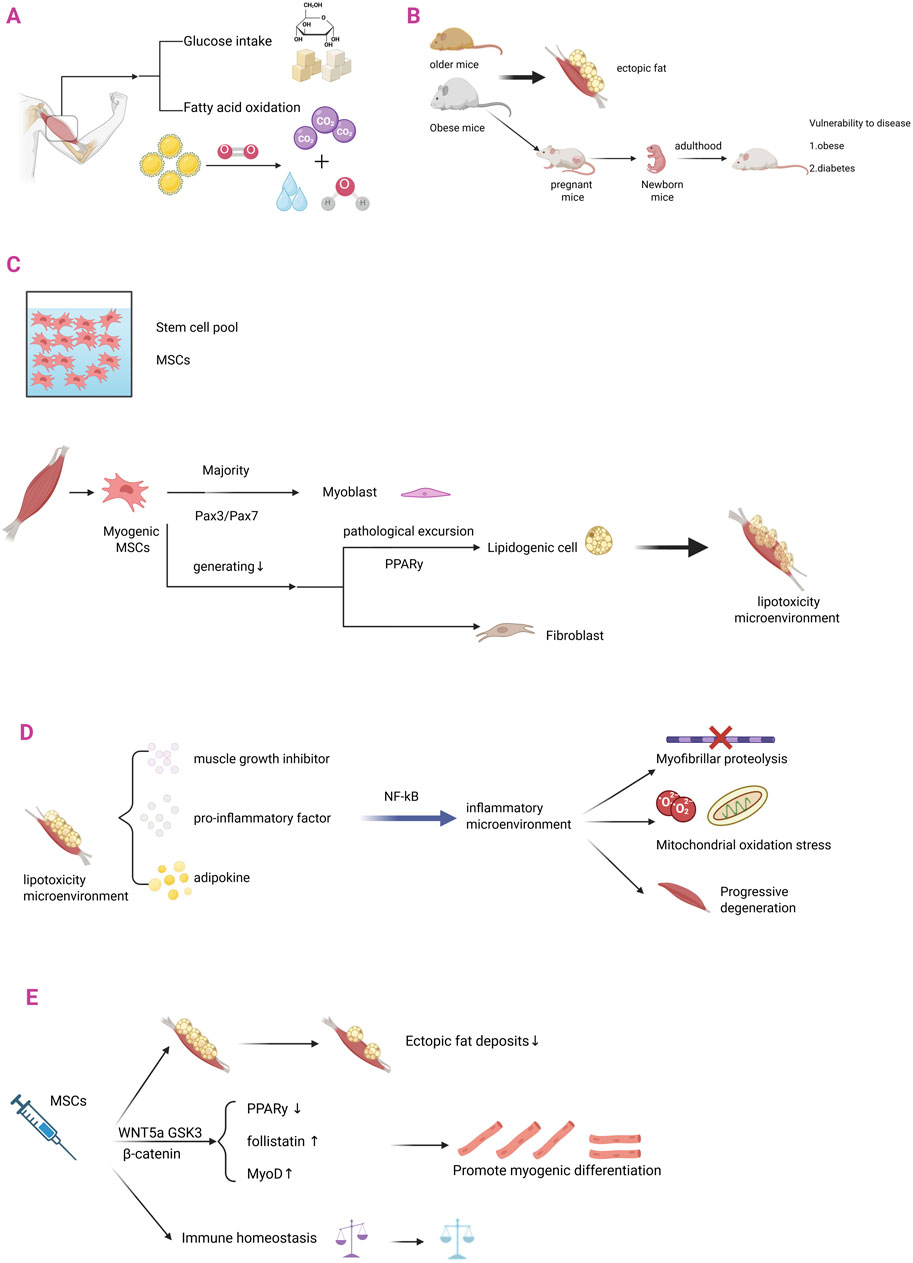 Diagram illustrating the process of ectopic fat deposition and muscle degeneration. Panel A shows metabolic processes involving glucose and fatty acids. Panel B depicts ectopic fat development in mice of varying ages, showing vulnerability to diseases like obesity and diabetes. Panel C focuses on muscle stem cells (MSCs) transforming into lipogenic cells and contributing to lipotoxicity. Panel D explains inflammatory pathways and their role in muscle degeneration. Panel F highlights interventions using MSCs and signaling pathways to reduce ectopic fat and promote muscle differentiation.