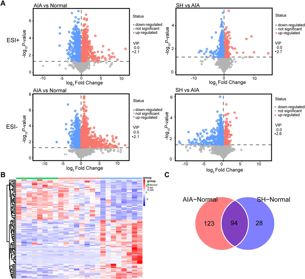 Panel A features four volcano plots displaying gene expression changes in different comparisons: AIA versus Normal and SH versus AIA, each with ESI+ and ESI- conditions. Genes are color-coded for status: down-regulated (blue), not significant (gray), up-regulated (red). Panel B is a heatmap showing gene expression across groups: Normal, SH, and AIA, with red and blue indicating expression levels. Panel C presents a Venn diagram comparing AIA versus Normal and SH versus Normal groups, with 123 unique to AIA, 28 unique to SH, and 94 overlapping.