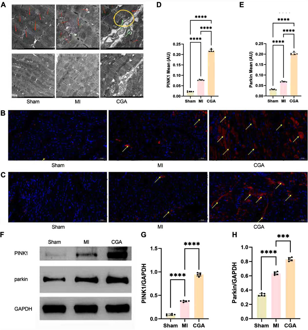 Composite figure featuring six panels: (A) Microscopic images in three conditions—Sham, MI, CGA—showing tissue variations annotated with arrows. (B) and (C) display fluorescence microscopy images with red and yellow arrows indicating specific features across conditions. (D) and (E) bar graphs depict PINK1 and Parkin levels, showing significant increases in CGA. (F) Western blot results for PINK1, Parkin, and GAPDH across conditions. (G) and (H) bar graphs showing PINK1/GAPDH and Parkin/GAPDH ratios with statistical significance marked by asterisks.