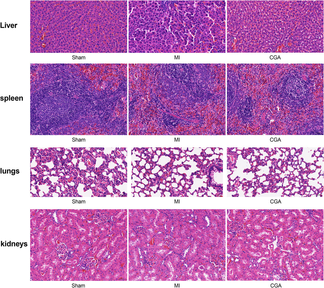 Microscopic images show tissue samples from liver, spleen, lungs, and kidneys arranged in rows. Each organ has three columns labeled Sham, MI, and CGA, depicting different experimental conditions. Liver images display uniform hepatocytes, spleen images show lymphoid tissue, lung images reveal alveolar structures, and kidney images exhibit nephron details. Hematoxylin and eosin staining highlights cellular features.