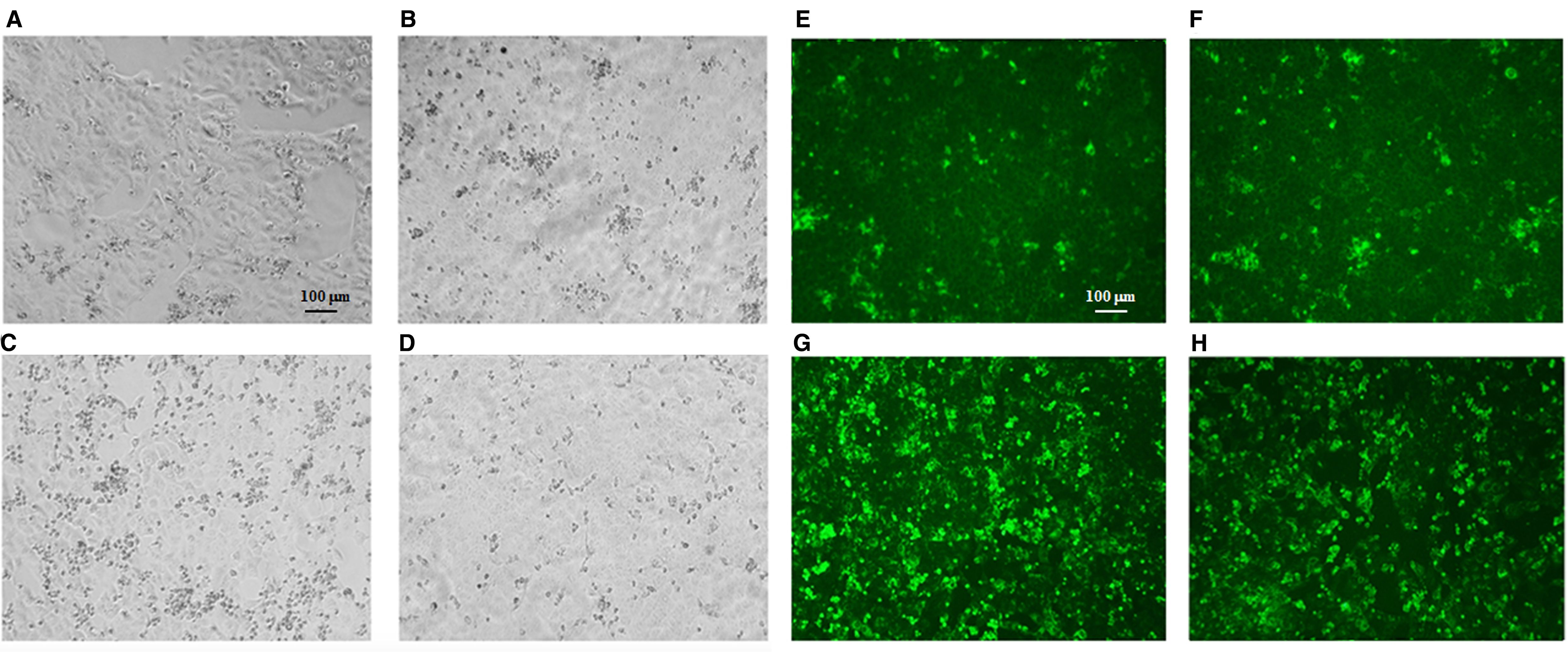 Microscopic images labeled A to H, showing cell cultures. A, B, E, and F are grayscale images displaying varying cytopathic effect. C, D, G, and H are fluorescent images with green markers highlighting TOSV-infected cells. Scale bars indicates 100 micrometers for reference.