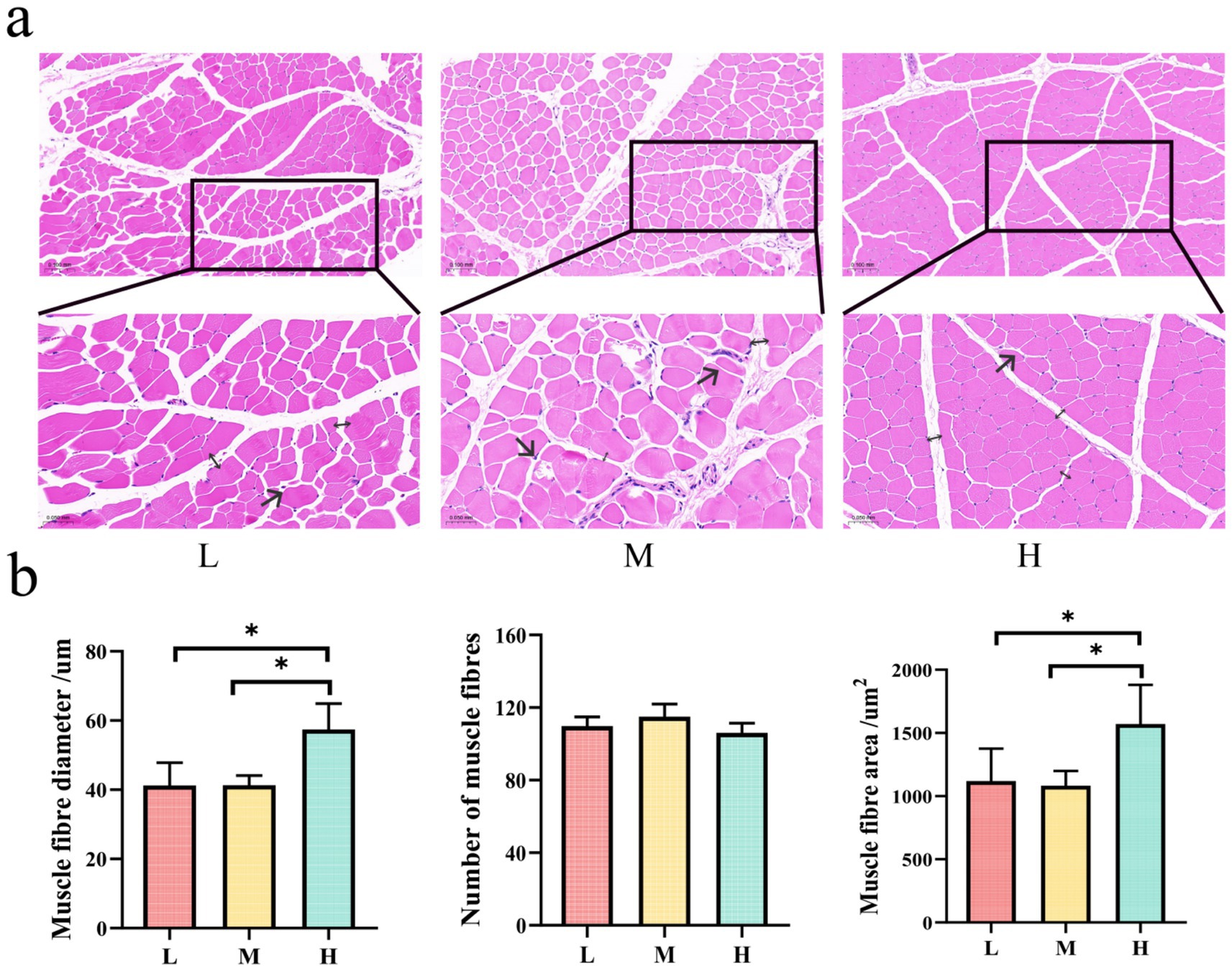 Panel (a) shows histological images of muscle fiber cross-sections for conditions L, M, and H, with insets highlighting differences in morphology. Panel (b) presents bar graphs comparing muscle fiber diameter, number, and area across L, M, and H. Significant differences are indicated with asterisks, showing variations in muscle fiber diameter and area, with H having the largest values.