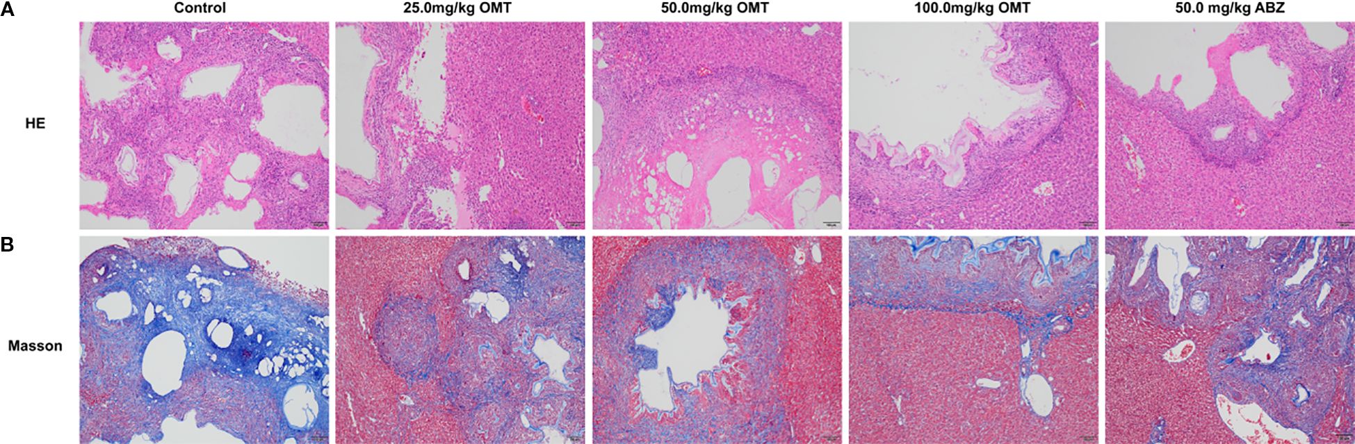 Histological comparison showing two rows of images. Row A presents hematoxylin and eosin (HE) stained slides under different treatments: Control, 25 mg/kg OMT, 50 mg/kg OMT, 100 mg/kg OMT, and 50 mg/kg ABZ. Row B shows Masson's trichrome stained slides for the same treatments. Variations in tissue structure and fibrosis are visible across different concentrations and treatments.