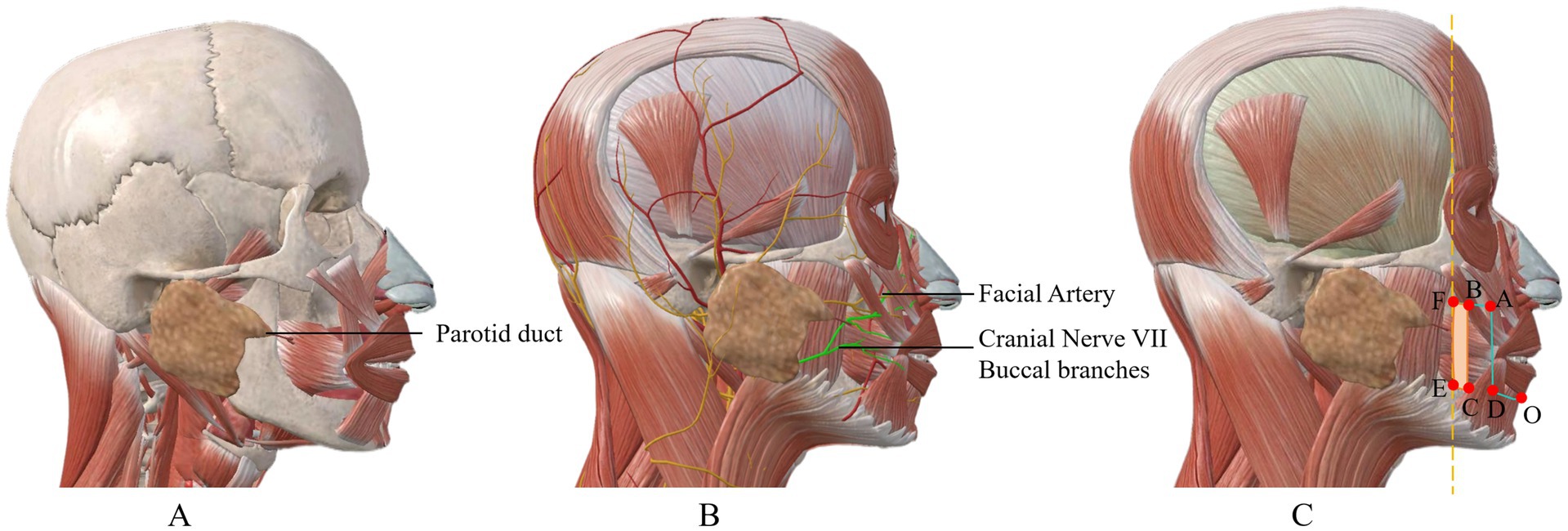 Three panels showing anatomical illustrations of the head. Panel A highlights the parotid duct. Panel B shows facial nerve branches, labeled as Cranial Nerve VII and buccal branches. Panel C includes several labeled points along the face, with a vertical line indicating measurements. The parotid gland is visible in all panels.
