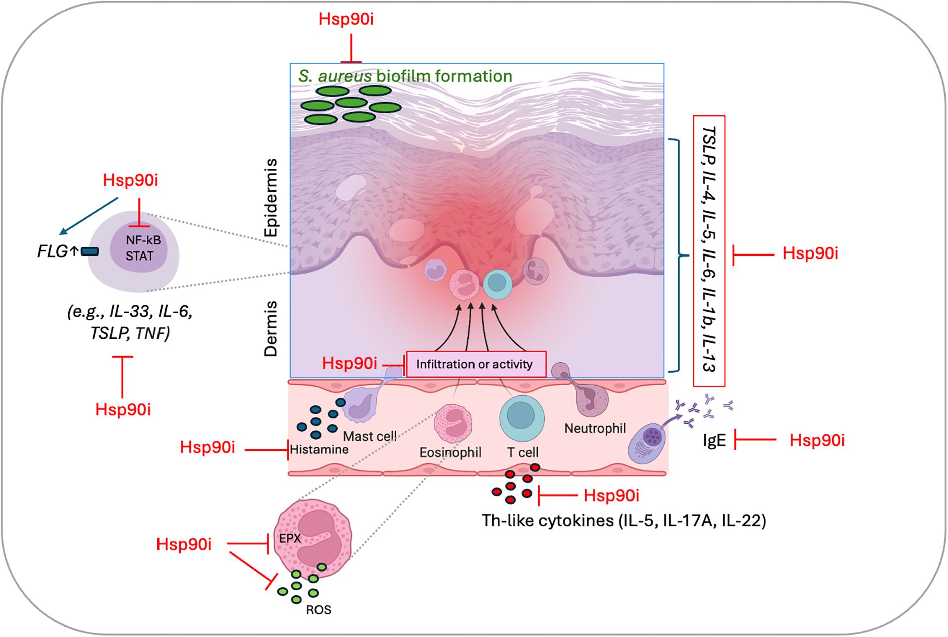 Diagram illustrating the role of Hsp90 inhibitors (Hsp90i) in skin inflammation. It shows S. aureus biofilm formation on the epidermis and how Hsp90i suppress various immune responses, including FLG expression, NF-kB/STAT signaling, and cytokine production (e.g., IL-33, IL-6). The diagram also depicts Hsp90i's effects on immune cell activity in the dermis, inhibiting mast cell histamine release, eosinophil activity, and the production of Th-like cytokines (IL-5, IL-17A, IL-22).