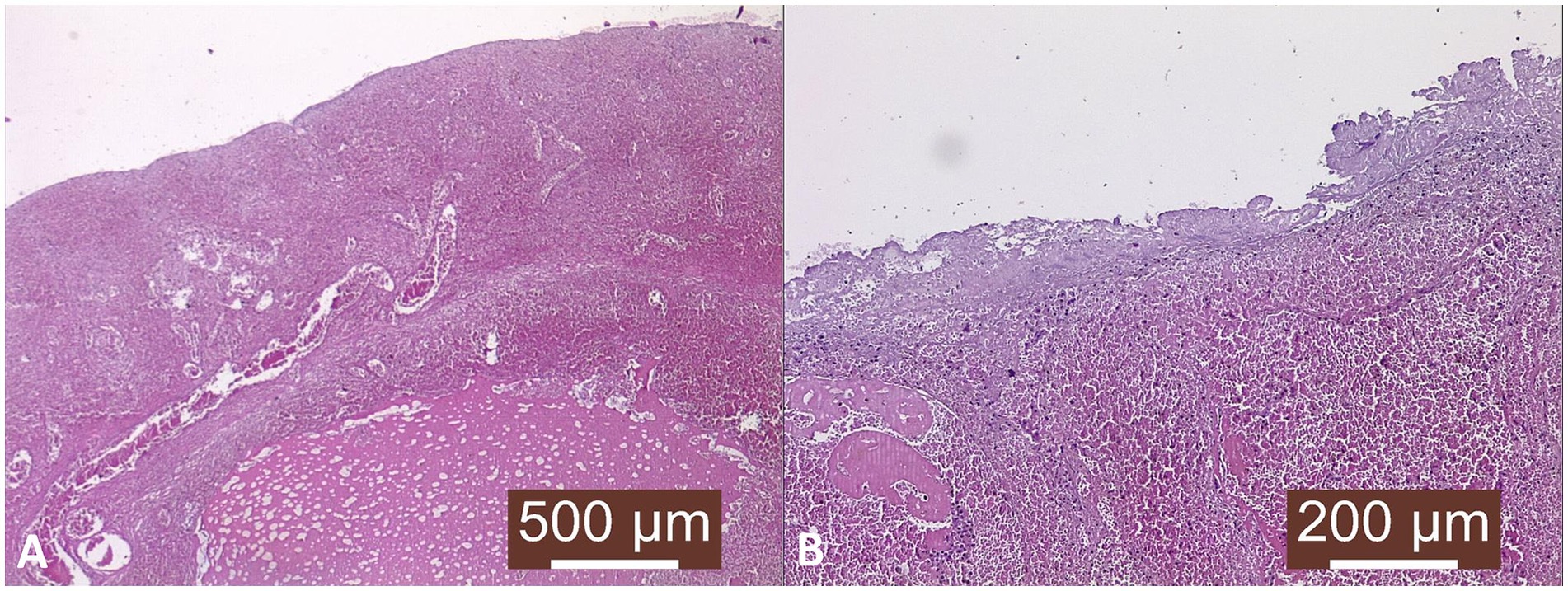 Histological comparison of tissue sections stained and magnified, panel A at five hundred micrometers and panel B at two hundred micrometers. Both panels show purple-stained cellular structures and varying densities within the tissue samples.