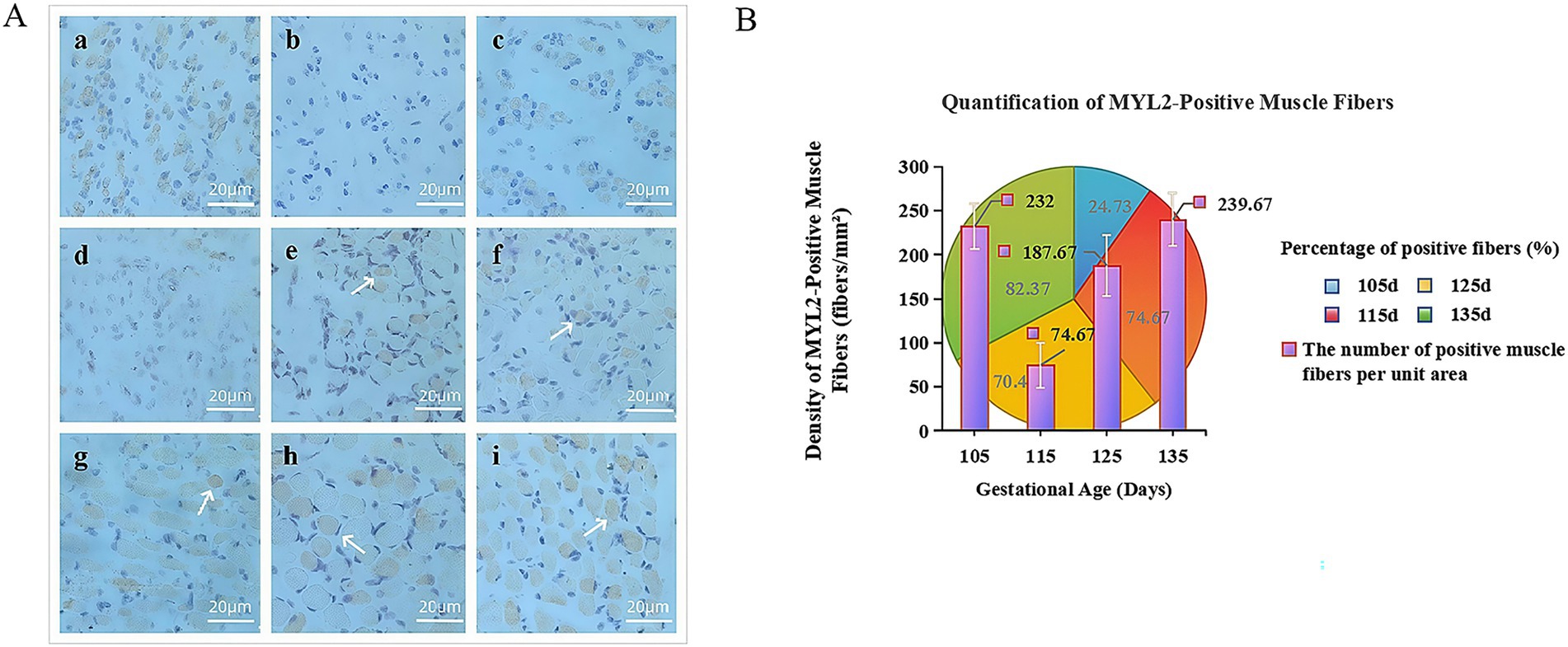 Panel A shows micrographs labeled a-i, displaying MYL2-positive muscle fibers stained in varying densities, with scale bars indicating 20 micrometers. Panel B is a bar and pie chart illustrating the quantification of MYL2-positive muscle fibers. The bar chart shows fiber density at gestational ages 105, 115, 125, and 135 days. The pie chart indicates the percentage distribution of positive fibers for these ages.
