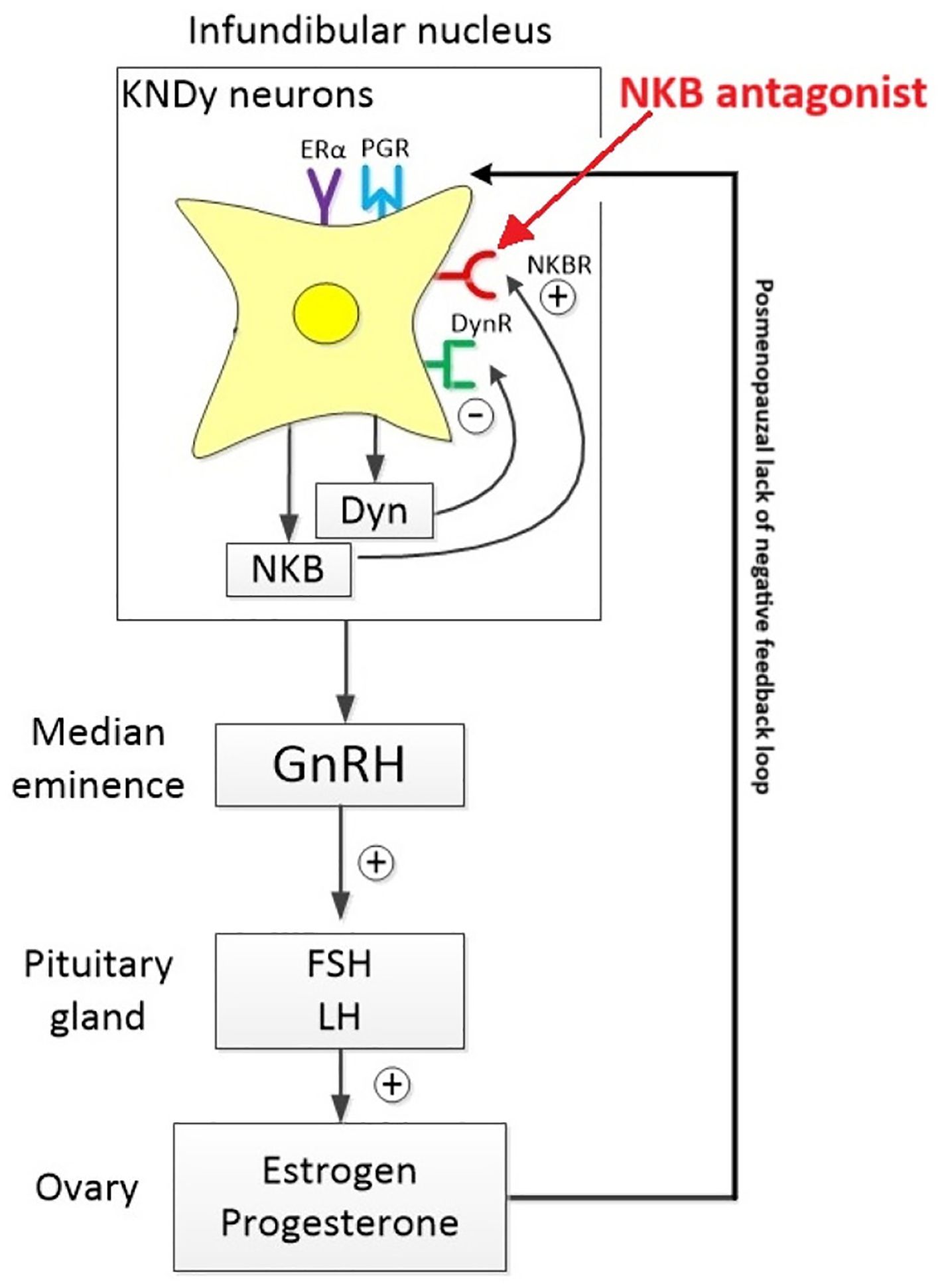 Diagram of the hormonal feedback loop in KNDy neurons within the infundibular nucleus. It shows NKB and Dyn effects on GnRH release, influenced by NKB antagonist. Pathways to the pituitary gland and ovary, highlighting estrogen and progesterone production, and the postmenopausal lack of negative feedback.