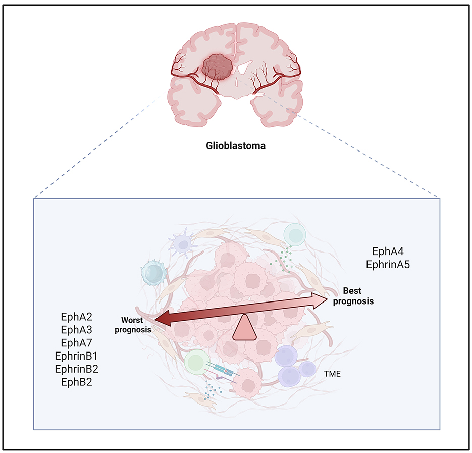 Diagram illustrating the influence of Eph receptors and ephrins on glioblastoma prognosis. The top shows a brain with a labeled glioblastoma. Below, a balance scale shifts from worst prognosis (with EphA2, EphA3, EphA7, EphrinB1, EphrinB2, EphB2) to best prognosis (with EphA4, EphrinA5) within the tumor microenvironment (TME).