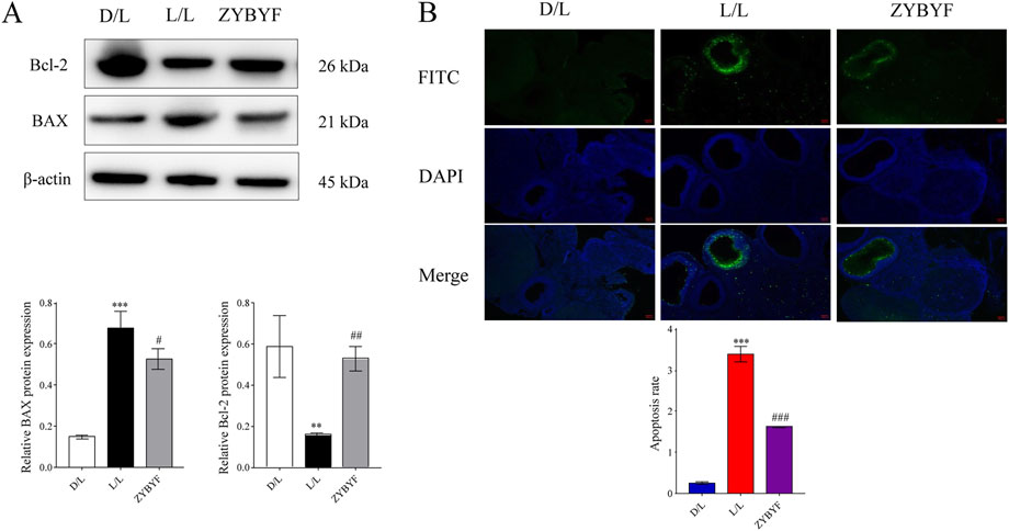 Panel A shows Western blot results for Bcl-2, BAX, and β-actin proteins with relative expression bar graphs below. Panel B displays immunofluorescence images with FITC and DAPI staining for D/L, L/L, and ZYBYF groups. Below are bar graphs representing apoptosis rates in different groups.