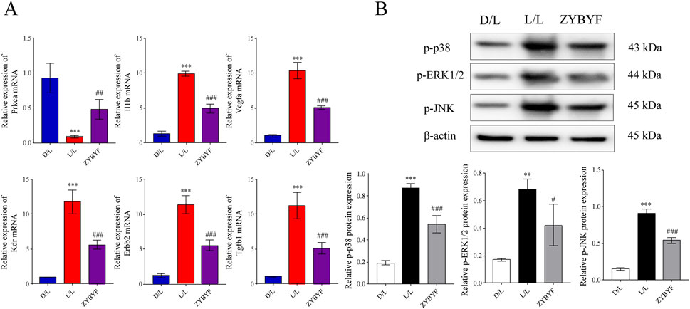 Panel A displays bar graphs illustrating the relative expression levels of various mRNAs (Prkca, Itgb, Vegfa, Kdr, Erbb2, Tgfb1) across different groups (D/L, L/L, ZYBYF). Significant differences are indicated by asterisks and hashes. Panel B includes Western blot images and corresponding bar graphs of protein expressions (p-p38, p-ERK1/2, p-JNK, β-actin) for the same groups, with protein sizes indicated (43-45 kDa). Differences are also marked with asterisks and hashes.