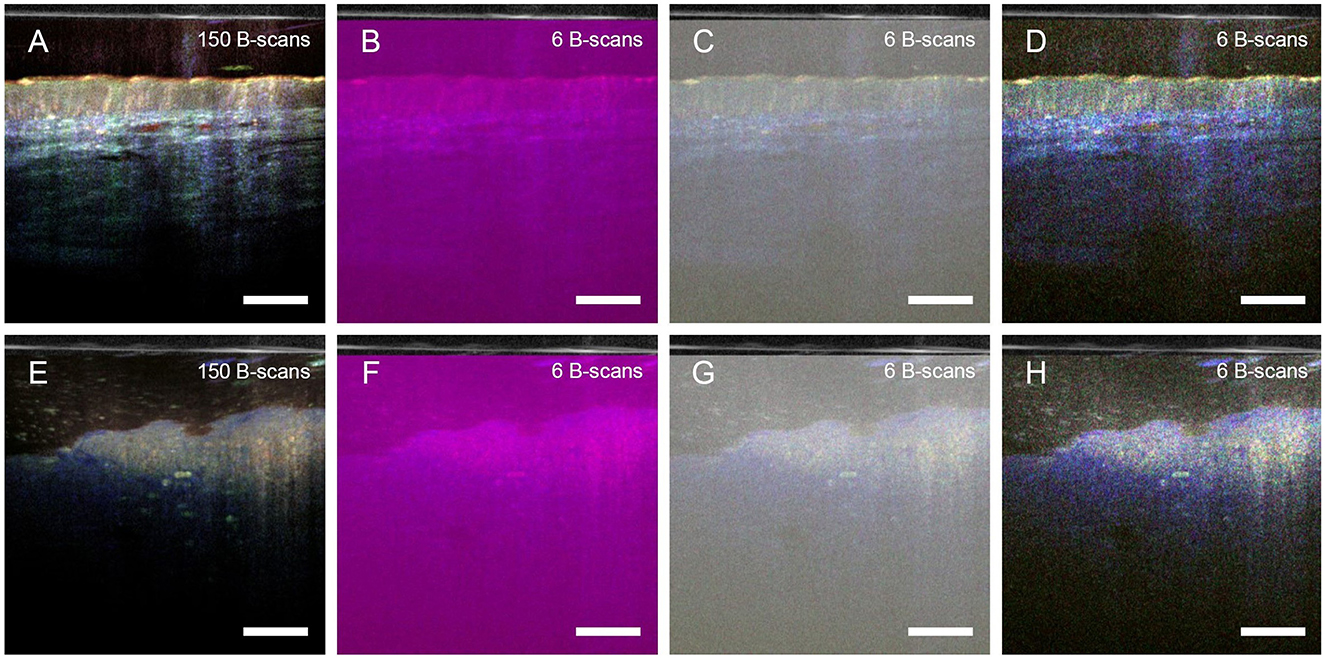 Eight panels of B-scan images are shown, labeled A to H. Panels A and E display images with 150 B-scans, showing detailed layers with color variations. Panels B, F, C, and G feature 6 B-scans in shades of purple and gray with less detail. Panels D and H also show 6 B-scans with visible segmentation in color tones. Each image has a scale bar for reference.