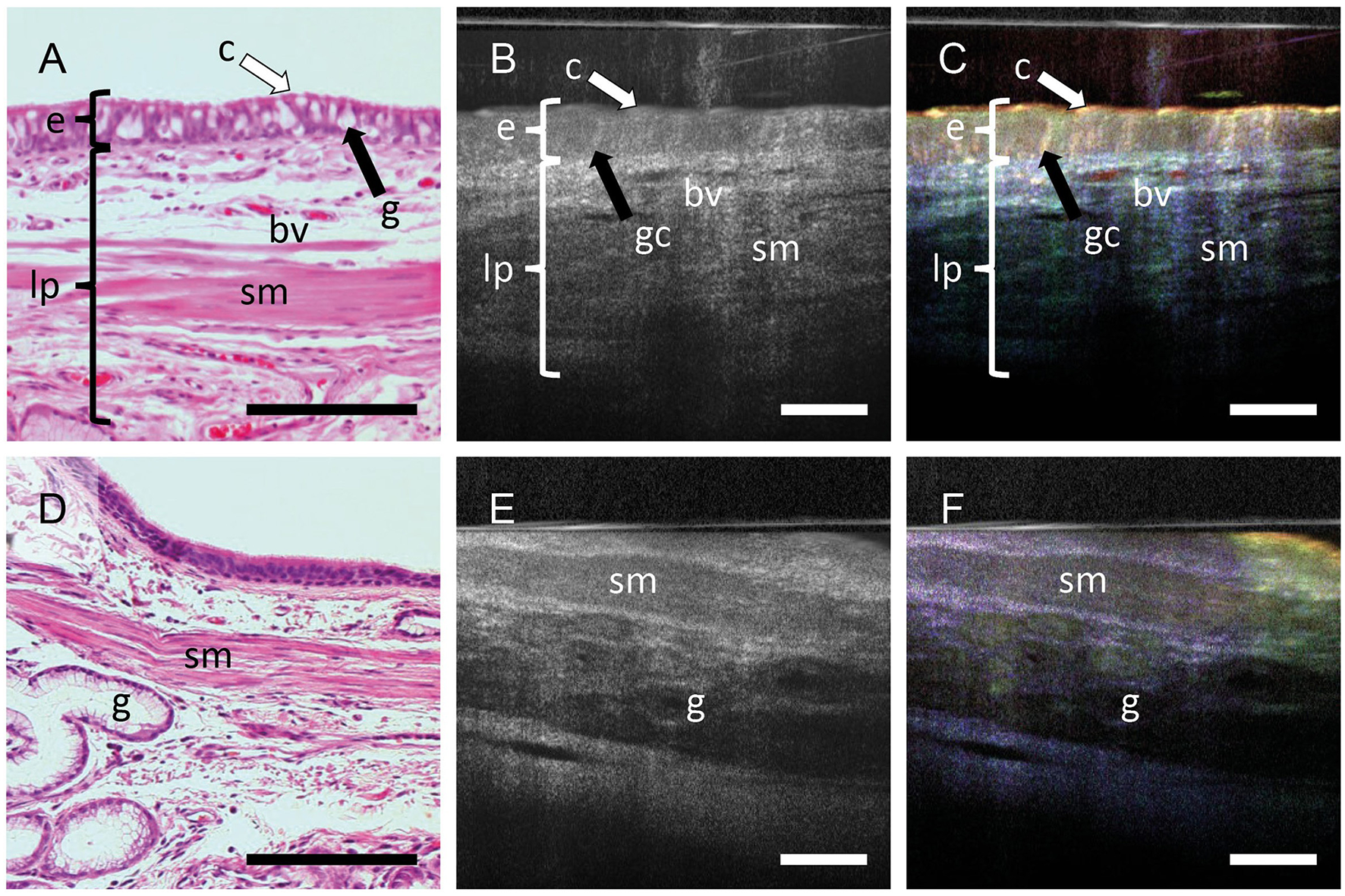 Histological and imaging analysis of tissue sections. Panels A and D show stained histological images highlighting structures like the epithelium (e), connective tissue (c), glands (g), blood vessels (bv), lamina propria (lp), and submucosa (sm). Panels B, C, E, and F display OCT images with labels for similar structures. White and black arrows in A to C point to different epithelial cells types. Each panel includes a scale bar for size reference.