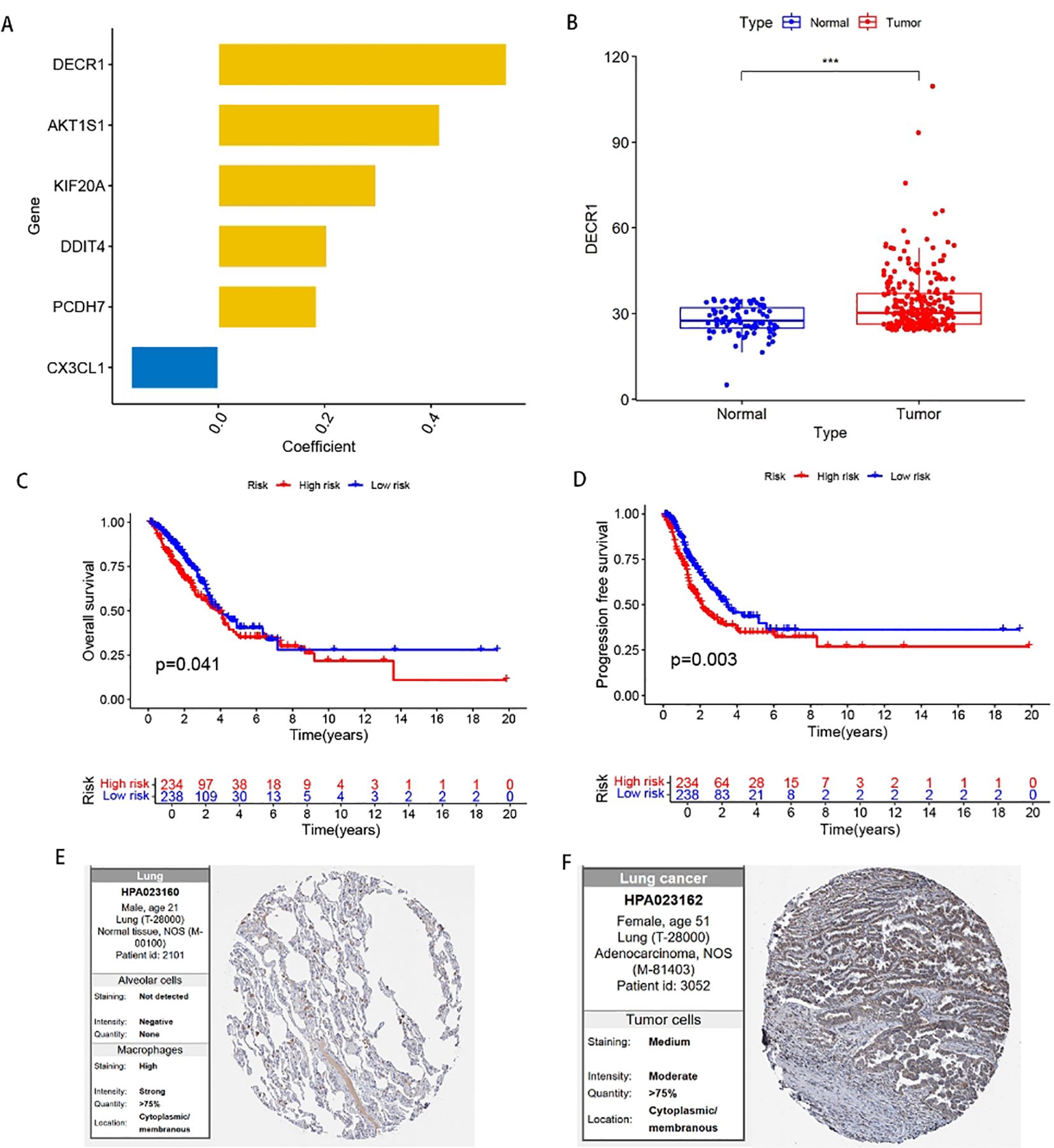 Panel A presents a horizontal bar graph showing coefficients of genes, including DECR1 and CX3CL1. Panel B displays a box plot comparing DECR1 expression in normal versus tumor samples, showing higher expression in tumors (p-value indicated by asterisks). Panel C is a Kaplan-Meier curve for overall survival, with significant differences between high-risk (red) and low-risk (blue) groups (p=0.041). Panel D shows a similar Kaplan-Meier curve for progression-free survival (p=0.003). Panel E and F show micrographs of lung tissues stained for different cell types, with associated data on intensity and quantity.