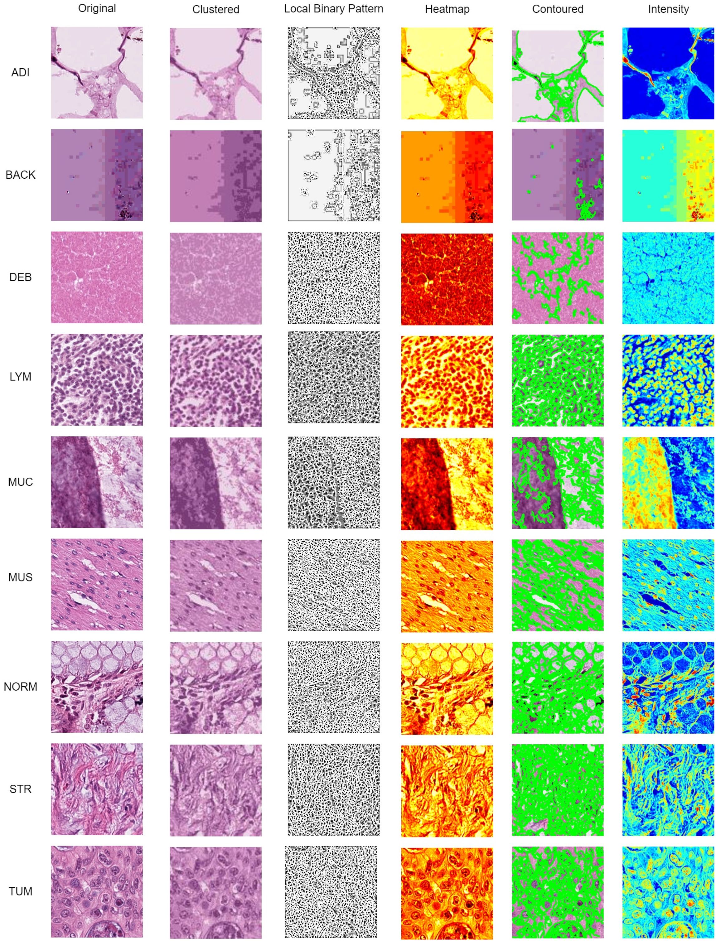 A grid of histological images showing tissue samples under different processing techniques. Each row represents a category: ADI, BACK, DEB, LYM, MUC, MUS, NORM, STR, and TUM. Columns display processing methods: Original, Clustered, Local Binary Pattern, Heatmap, Contoured, and Intensity. Each method reveals distinct visual features of the tissue samples, with variations in color and texture to highlight diverse aspects and structures within the tissues.