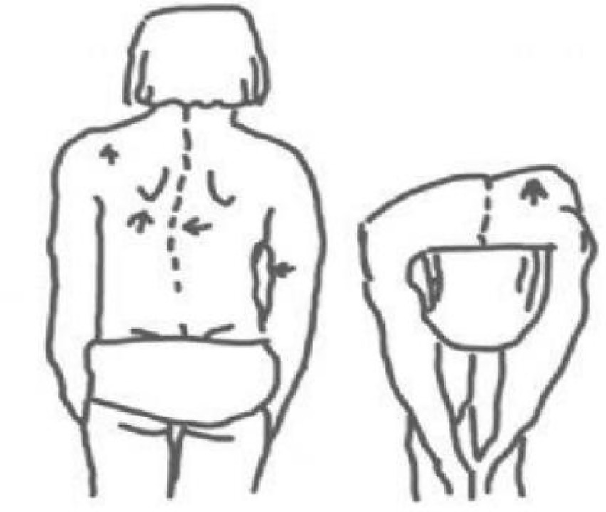 Drawing of a person viewed from the back and from a bent-over position. Arrows indicate muscle and joint movement directions along the spine and limbs.