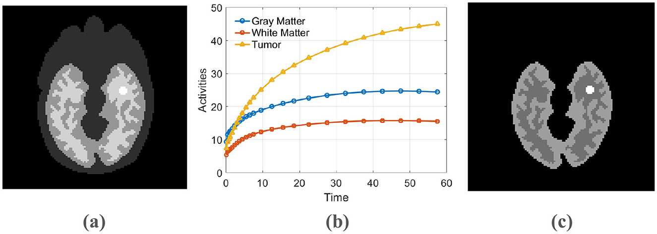 (a) A grayscale brain scan highlighting a bright spot representing a tumor on the right side. (b) A graph showing activity levels over time for gray matter, white matter, and a tumor, with the tumor showing the highest activity. (c) Another grayscale brain scan similar to (a), with the tumor indicated on the left side.