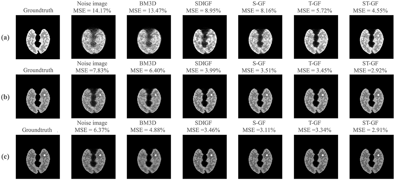 Three rows of brain images labeled (a), (b), and (c). Each row shows a progression from a ground truth image, followed by a noise image and five processed images labeled BM3D, SDIGF, S-GF, T-GF, and ST-GF, each with a Mean Squared Error (MSE) percentage. Image quality improves from left to right in each row.