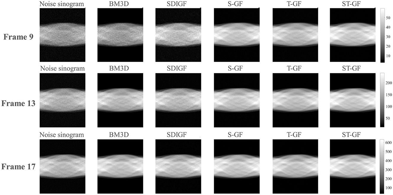 Sequential grid of sinogram images from three frames labeled as Frame 9, Frame 13, and Frame 17. Each frame contains six variations titled Noise sinogram, BM3D, SDIGF, S-GF, T-GF, and ST-GF. The images show different levels and styles of noise reduction or filtering, with adjacent grayscale bars indicating intensity levels.