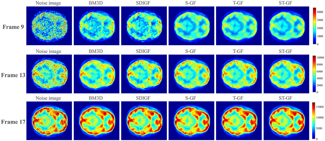 Series of brain scan images arranged in three rows labeled Frame 9, Frame 13, and Frame 17. Each row contains six columns labeled Noise image, BM3D, SDIGF, S-GF, T-GF, and ST-GF, showing different filtering techniques. The images are color-coded, with scales on the right correlating to numerical values from zero to four thousand or fifteen thousand, indicating intensity levels.