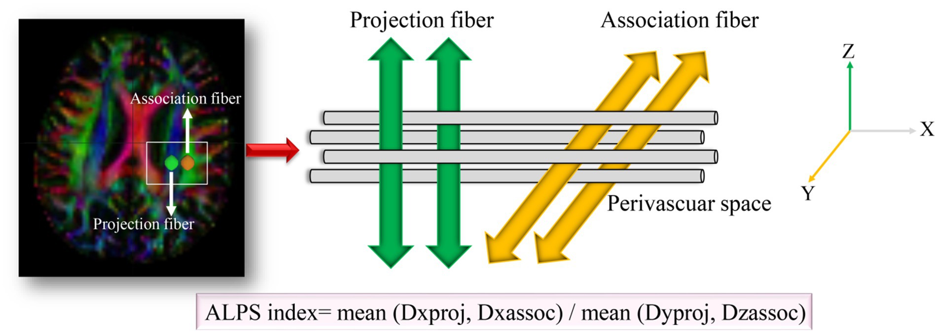Schematic diagram showing the method for acquiring ALPS index analysis in this study: ALPS index = (Dxxproj ÷ Dxxassoc) ÷ (Dyyproj ÷ Dzzassoc). An XYZ axis illustrates directionality. It reflects the diffusivity of association fiber and projection fiber.