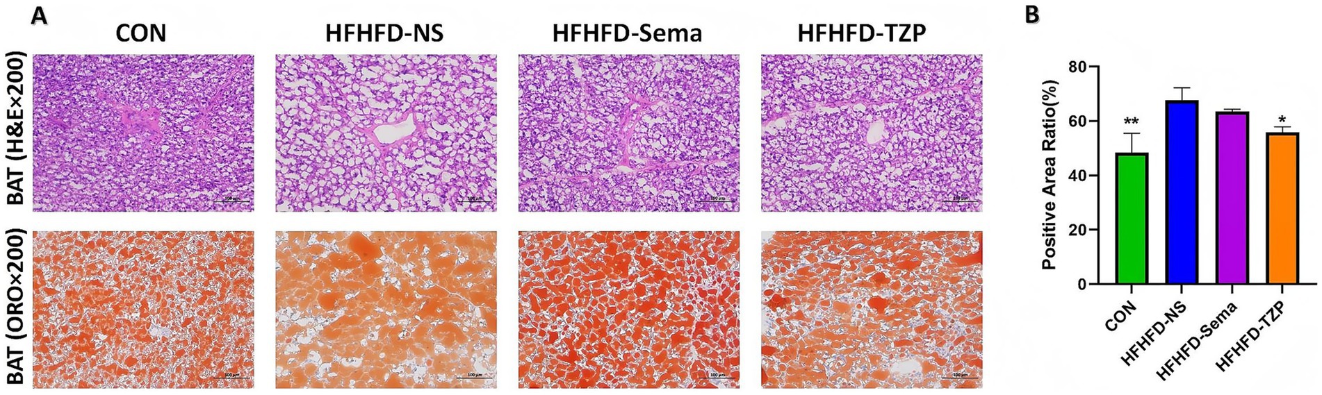 Figure A shows two rows of histology images labeled as CON, HFHFD-NS, HFHFD-Sema, and HFHFD-TZP, with H&E stains in the top row and ORO stains in the bottom. Figure B displays a bar graph of the positive area ratio percentage, comparing CON, HFHFD-NS, HFHFD-Sema, and HFHFD-TZP, with statistical significance indicated by asterisks.