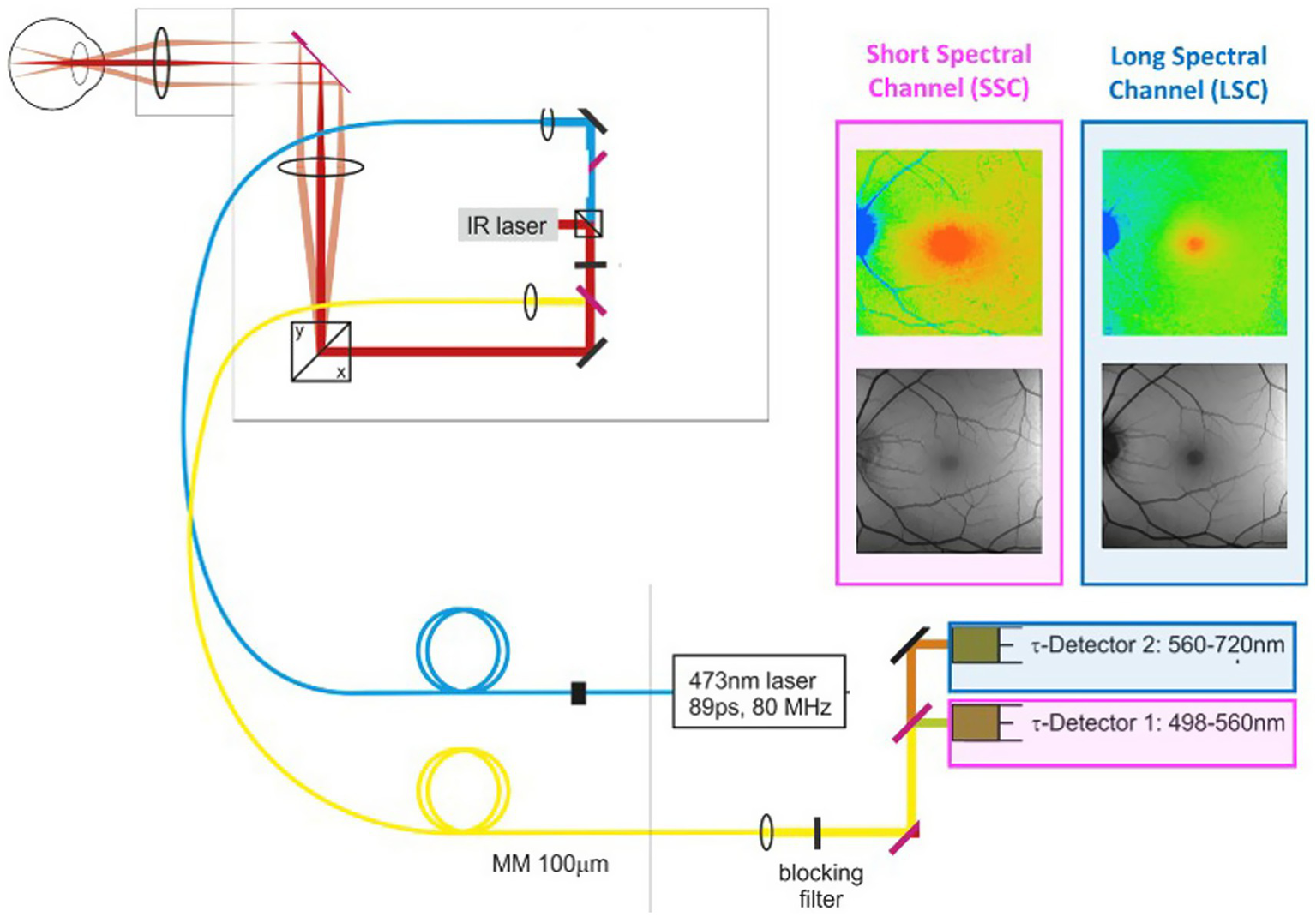 Optical system diagram for analyzing retinal images. A 473-nm pulsed laser enters the eye, exciting retinal fluorophores. The emitted fluorescence passes through lenses and mirrors before being split into two channels for simultaneous detection: a Short Spectral Channel (498–560 nm) and a Long Spectral Channel (560–720 nm). The system captures both colored and grayscale retinal images. Laser details include 89 picoseconds pulse duration at 80 MHz. Two detectors record the signals at specified wavelength ranges, with a blocking filter present in the pathway.