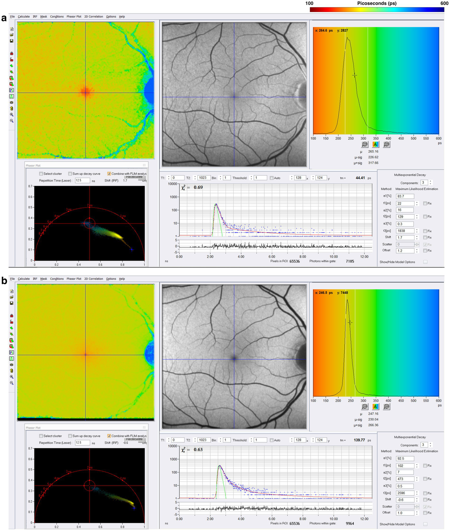 Two panels labeled “a” and “b” show retinal imaging around the macular region. Each includes a colormap highlighting regions of varying intensity, a grayscale image, histogram, phasor plot, and decay curve graphs. Color scales range from red (100 ps) to blue (600 ps). Histograms illustrate mean fluorescence lifetimes, with SSC and LSC channels showing uniform, single peaks in a healthy control. Quantitative analysis tools and measurement statistics are included to assess retinal fluorescence properties.